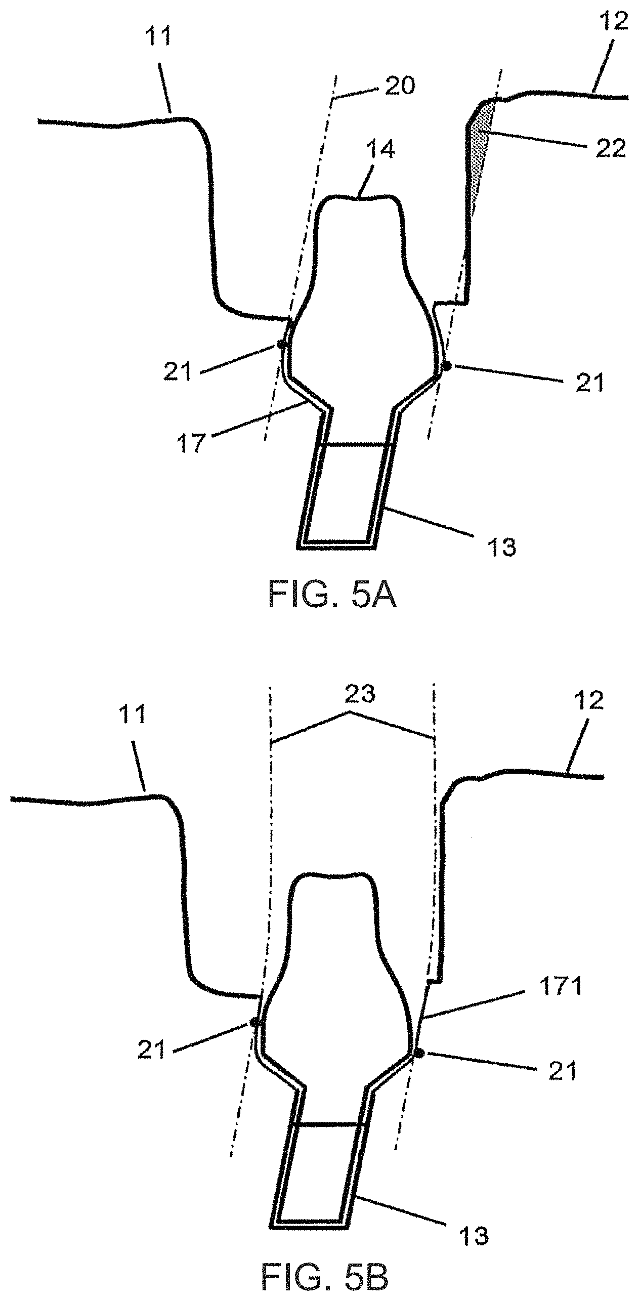 Patent US11779440 Figure 7 – Method of modifying the gingival part of a virtual model of a set of teeth