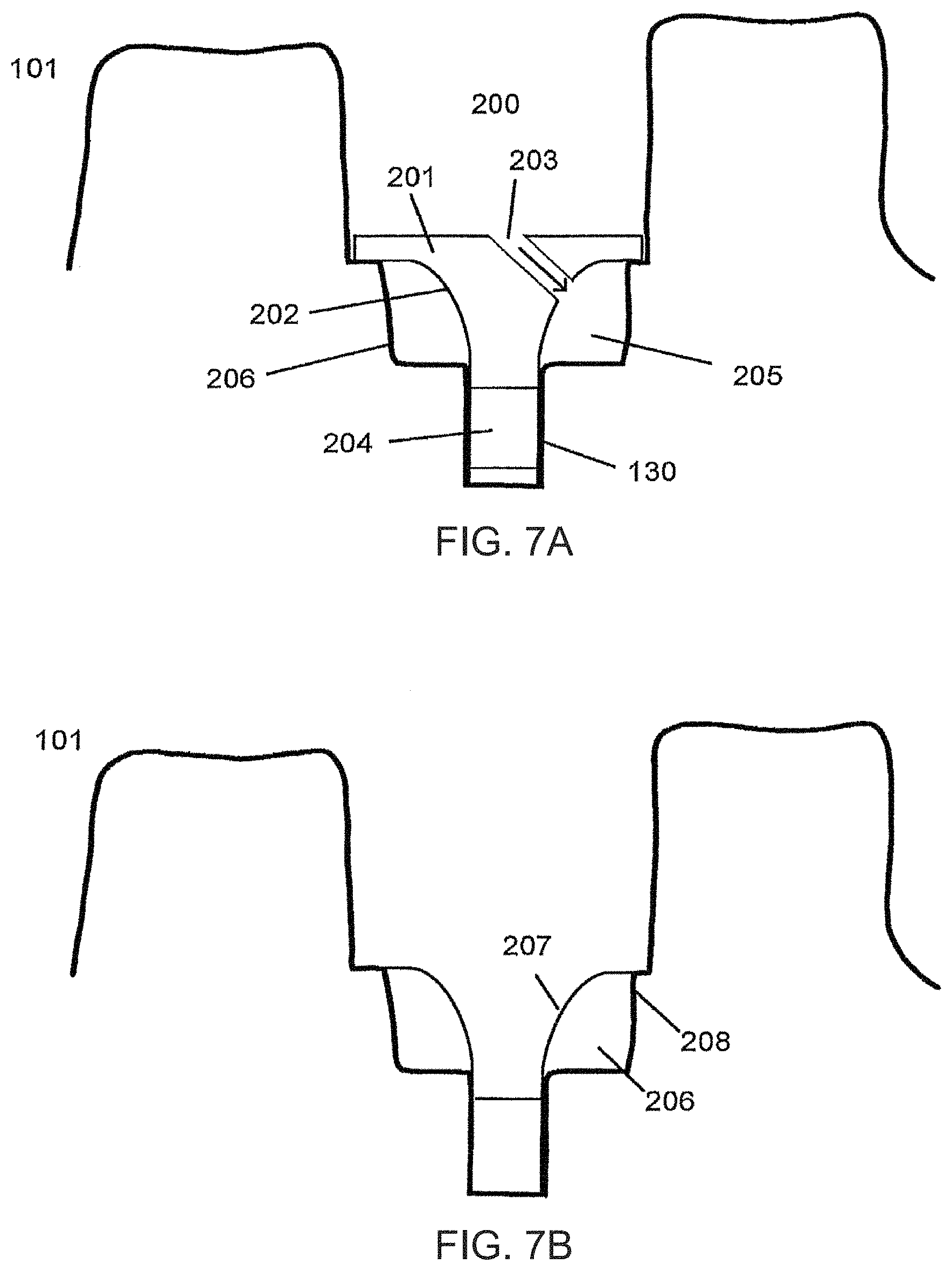 Patent US11779440 Figure 9 – Method of modifying the gingival part of a virtual model of a set of teeth