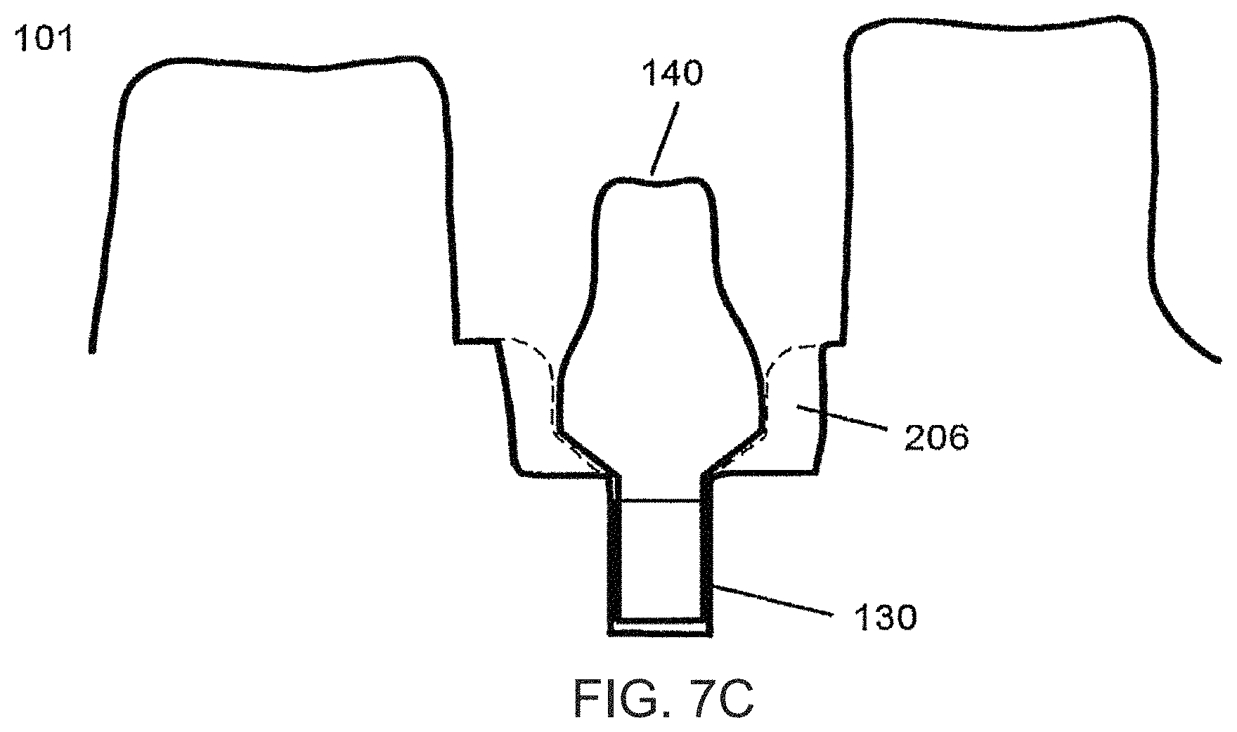 Patent US11779440 Figure 10 – Method of modifying the gingival part of a virtual model of a set of teeth