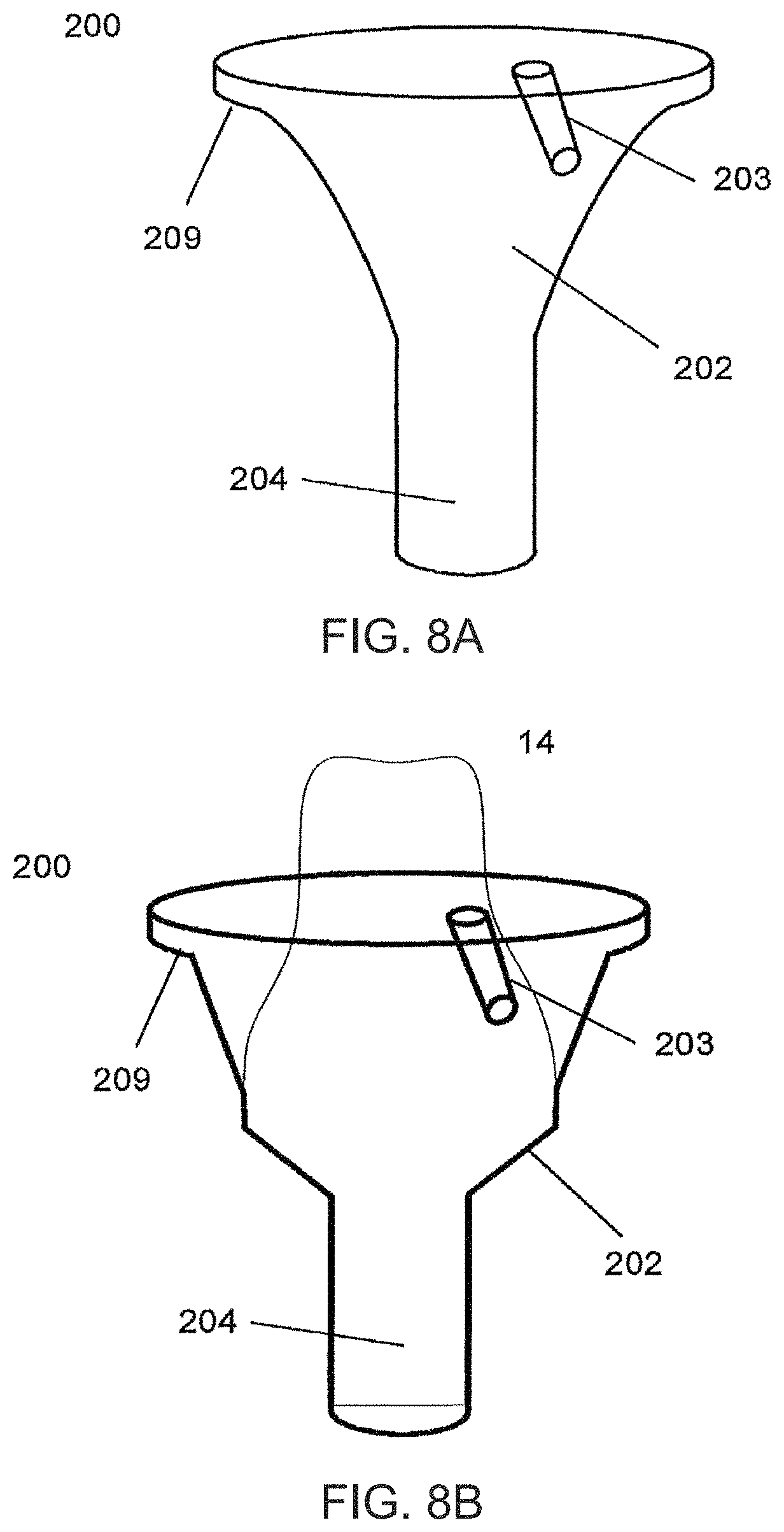 Patent US11779440 Figure 11 – Method of modifying the gingival part of a virtual model of a set of teeth