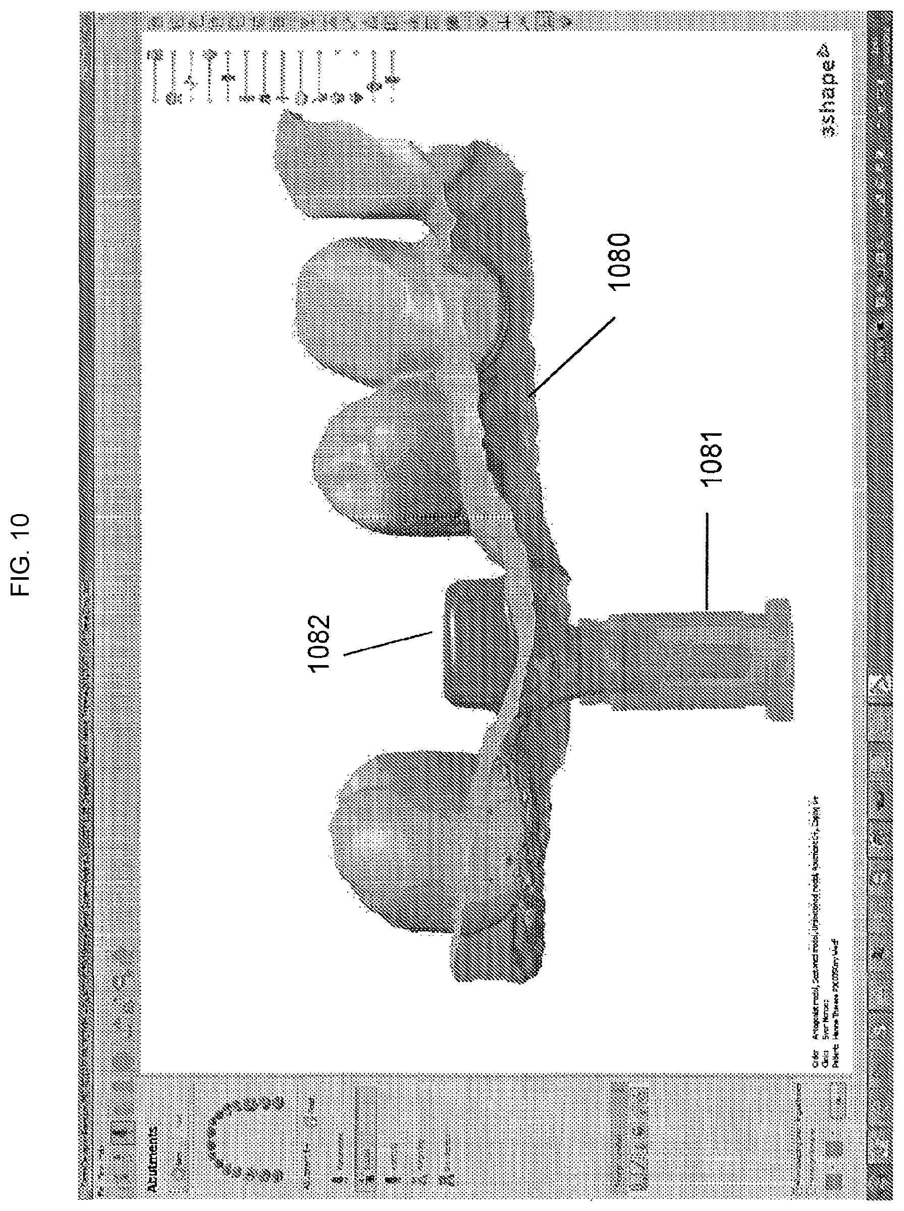 Patent US11779440 Figure 13 – Method of modifying the gingival part of a virtual model of a set of teeth