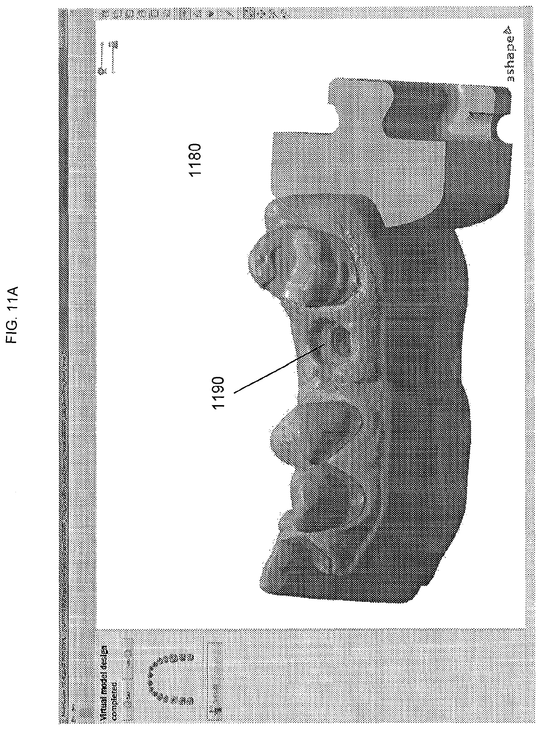 Patent US11779440 Figure 14 – Method of modifying the gingival part of a virtual model of a set of teeth