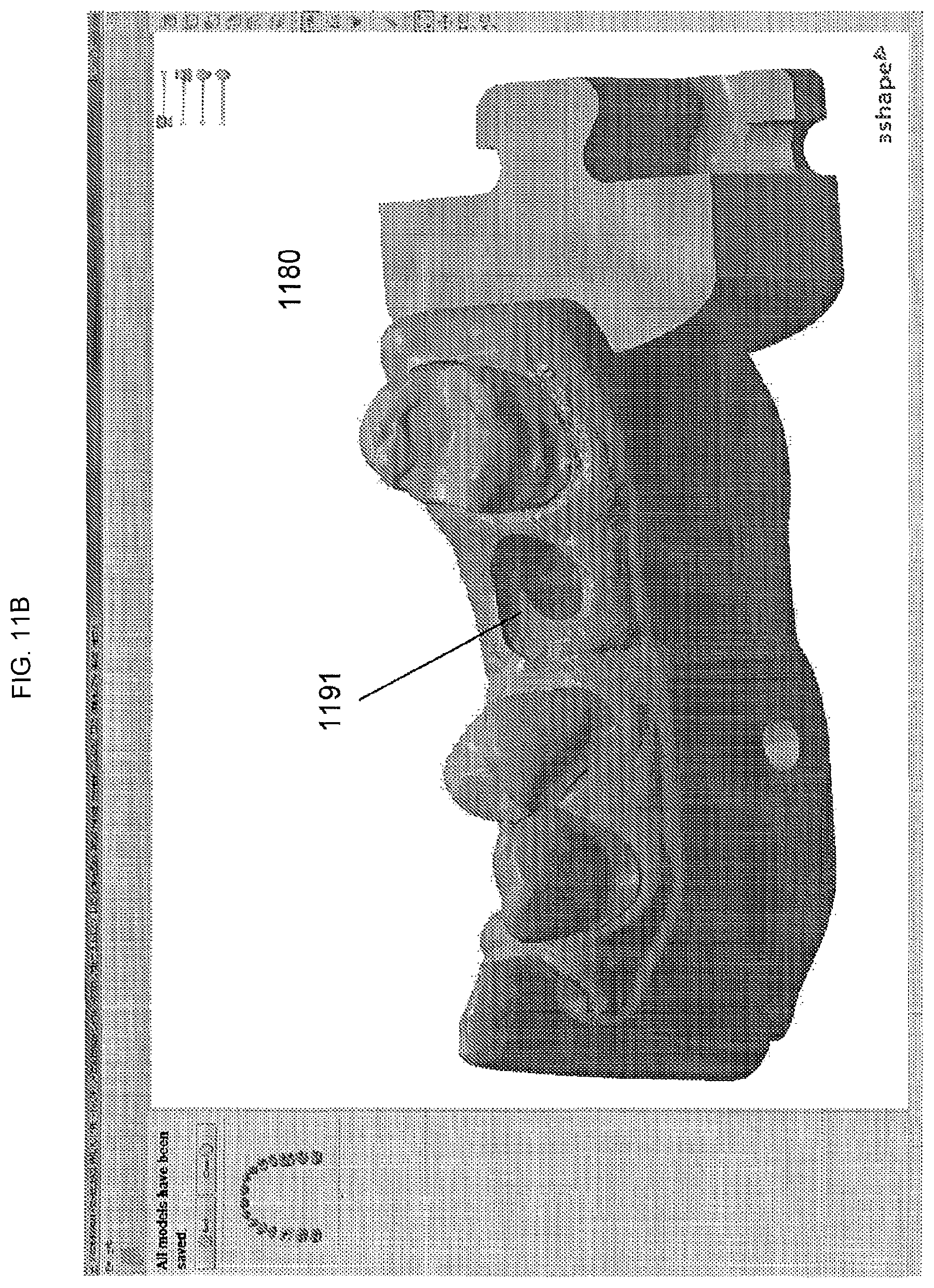 Patent US11779440 Figure 15 – Method of modifying the gingival part of a virtual model of a set of teeth