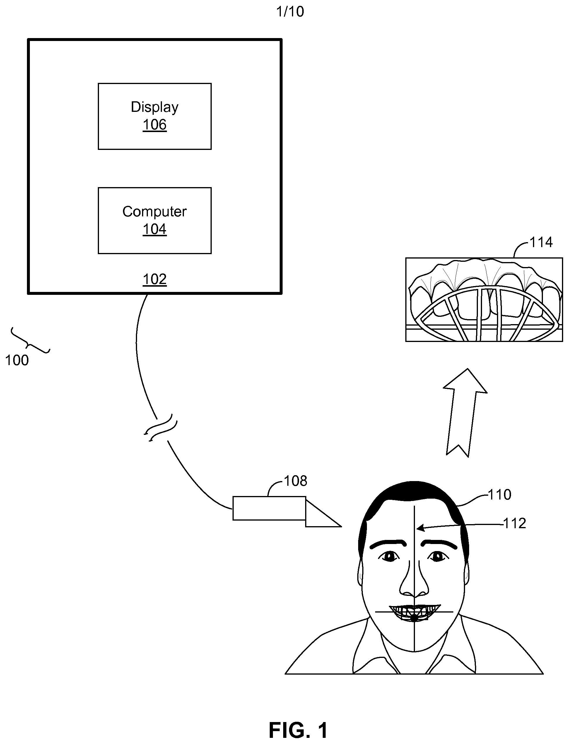 Patent US11779444 — Methods and systems for dental procedures — Figure 1