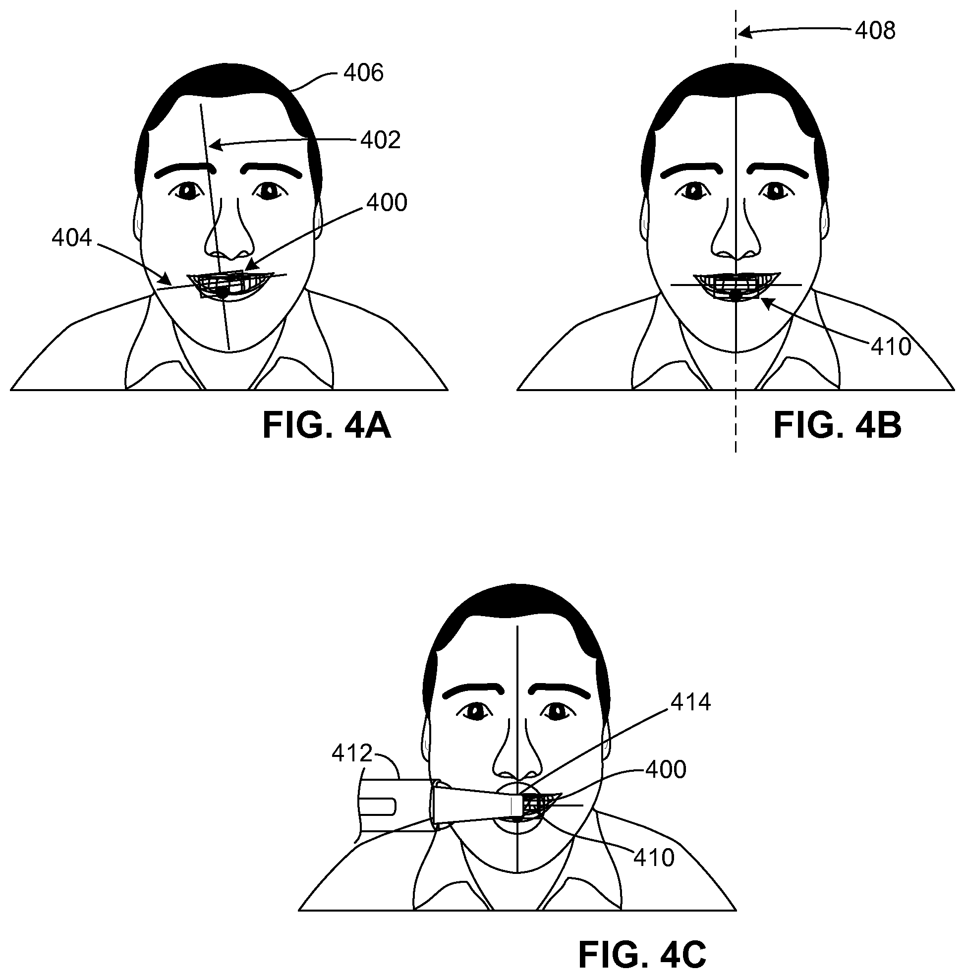 Patent US11779444 Figure 4 – Methods and systems for dental procedures