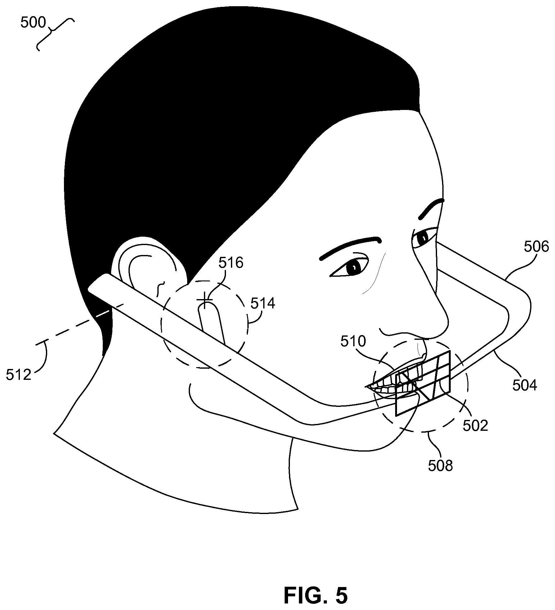 Patent US11779444 Figure 5 – Methods and systems for dental procedures