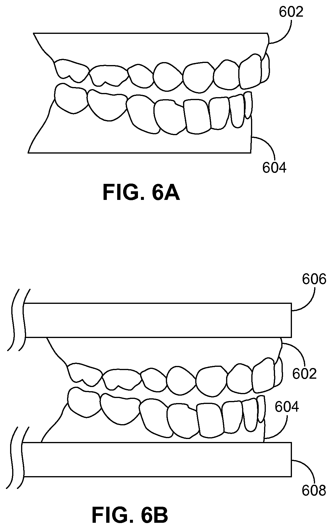 Patent US11779444 Figure 6 – Methods and systems for dental procedures