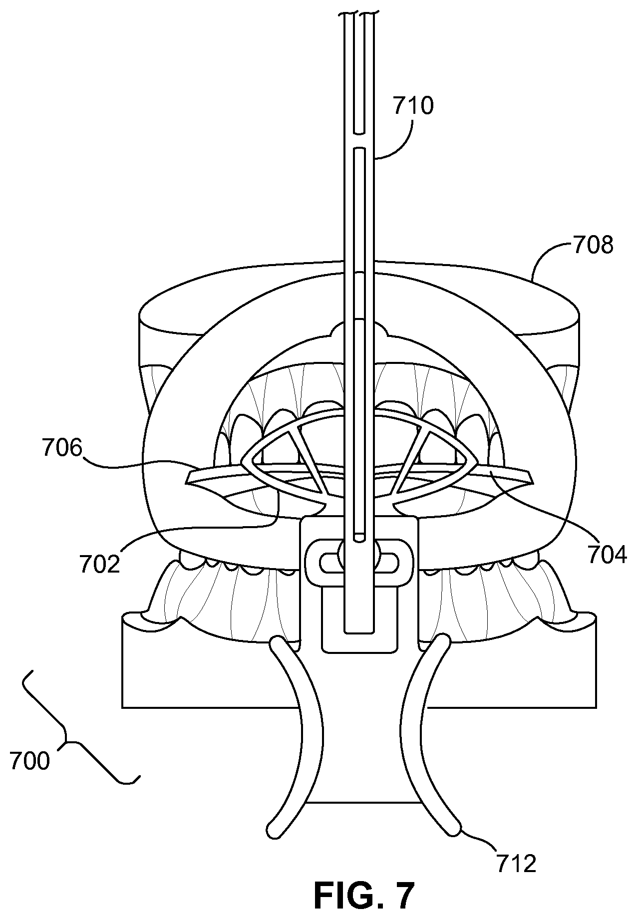 Patent US11779444 Figure 7 – Methods and systems for dental procedures