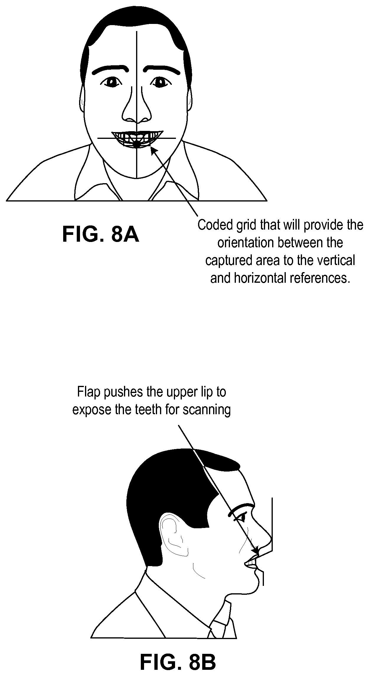 Patent US11779444 Figure 8 – Methods and systems for dental procedures