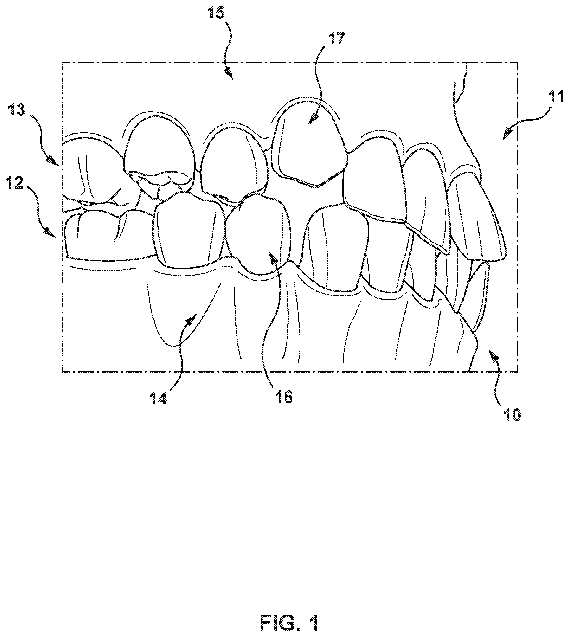 Patent US11779445 — Systems and methods for determining a bite position between teeth of a subject — Figure 1