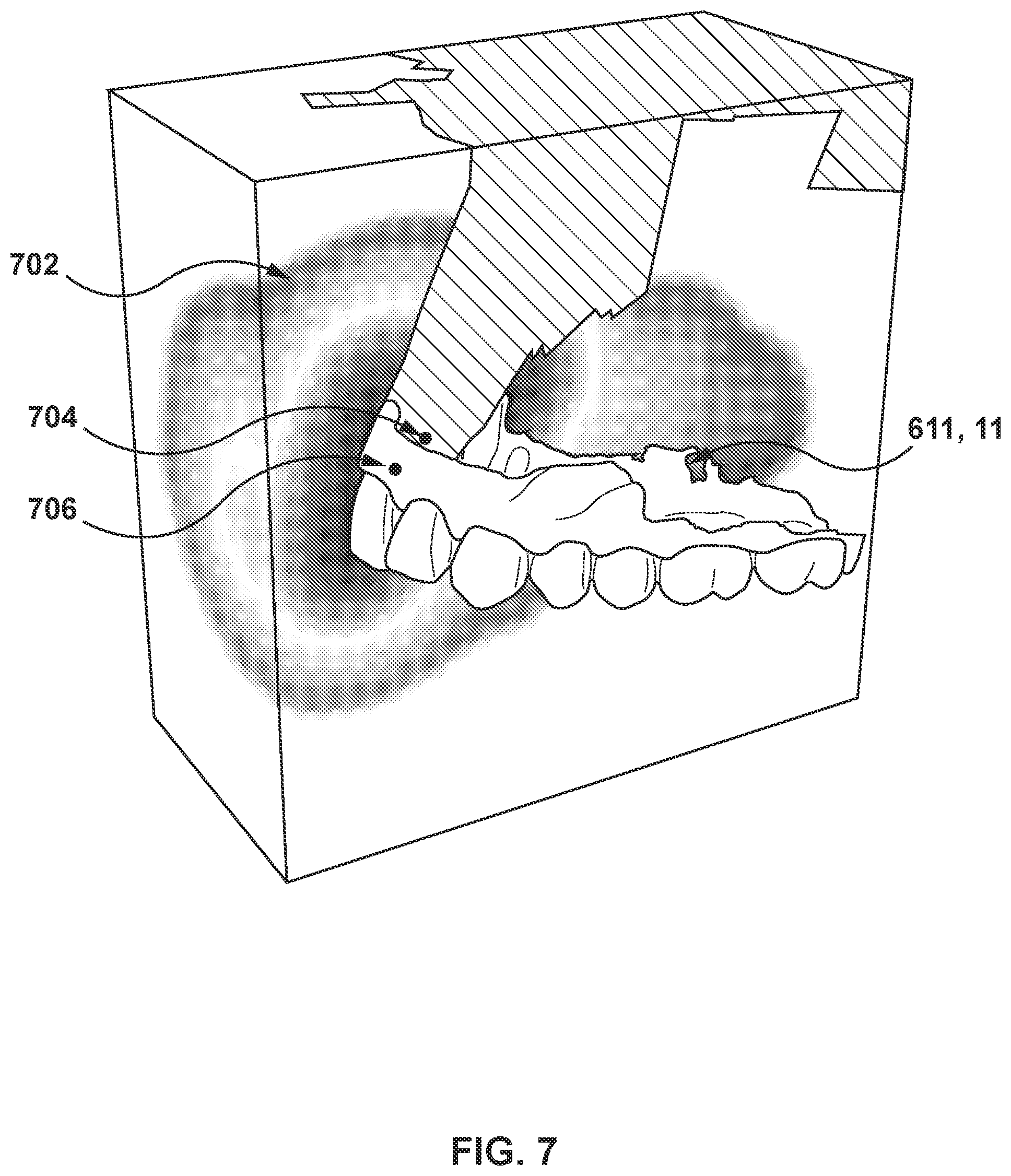 Patent US11779445 Figure 5 – Systems and methods for determining a bite position between teeth of a subject