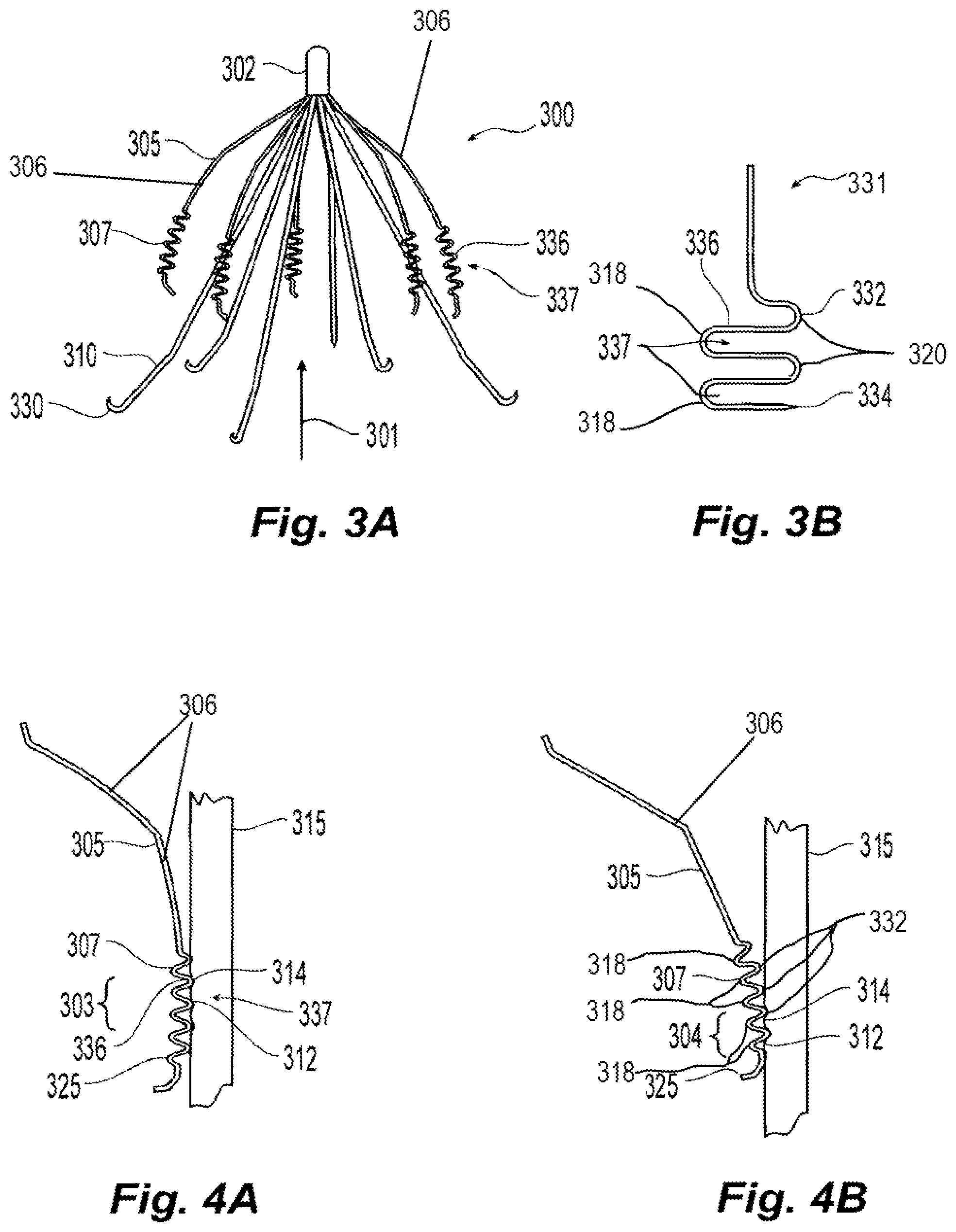 Patent US11779449 Figure 2 – Inferior vena cava filter with stability features