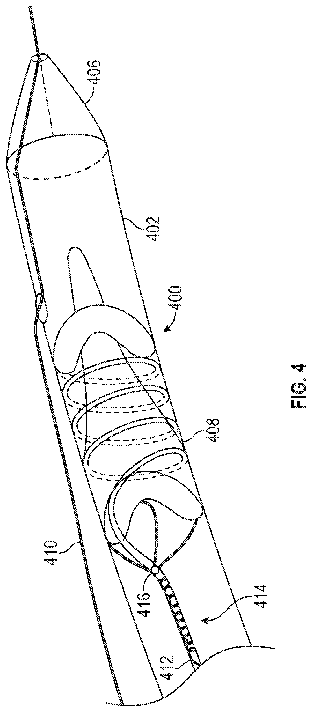 Patent US11779451 Figure 3 – Peripheral vascular filtration systems and methods
