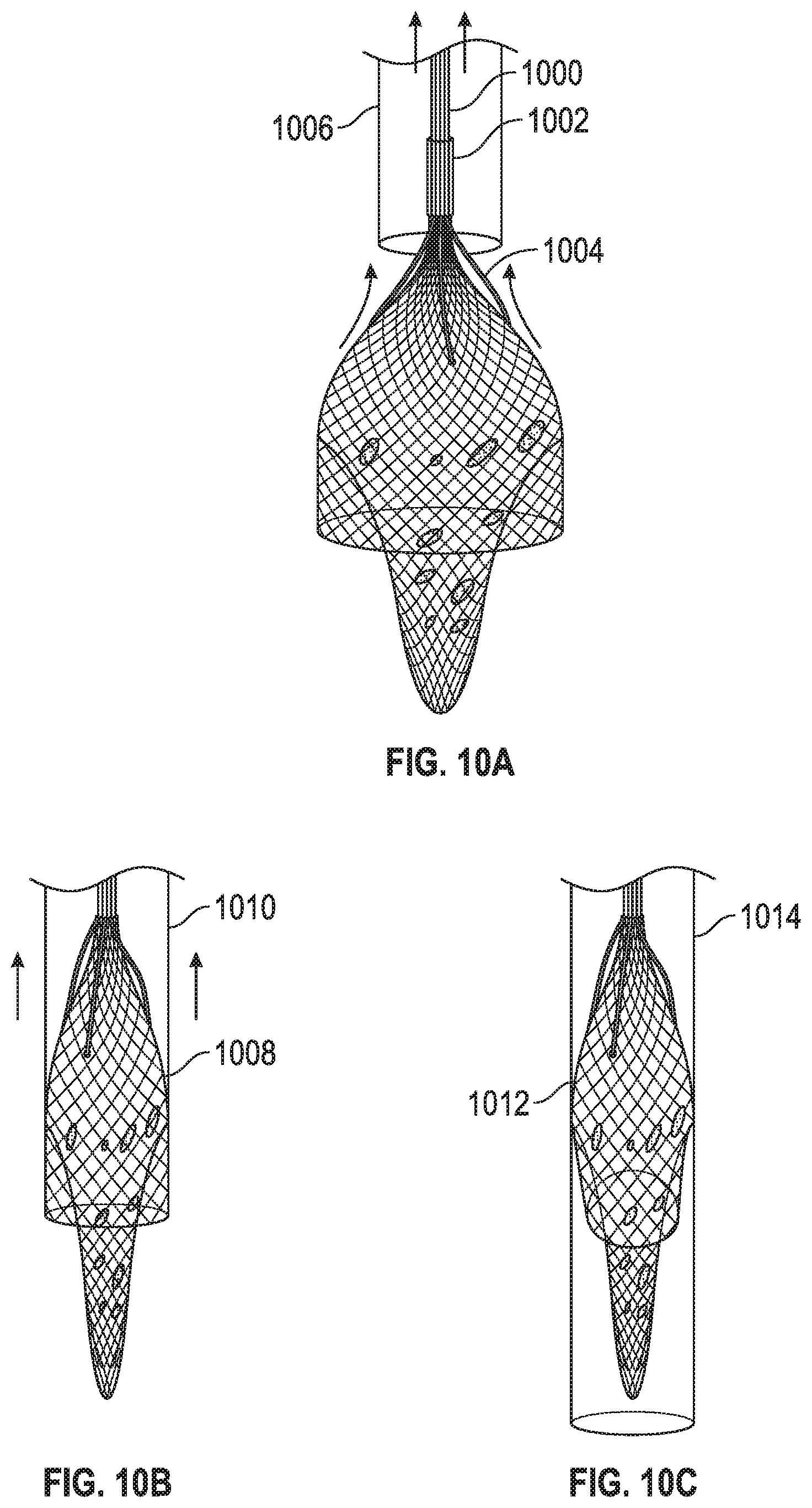 Patent US11779451 Figure 10 – Peripheral vascular filtration systems and methods