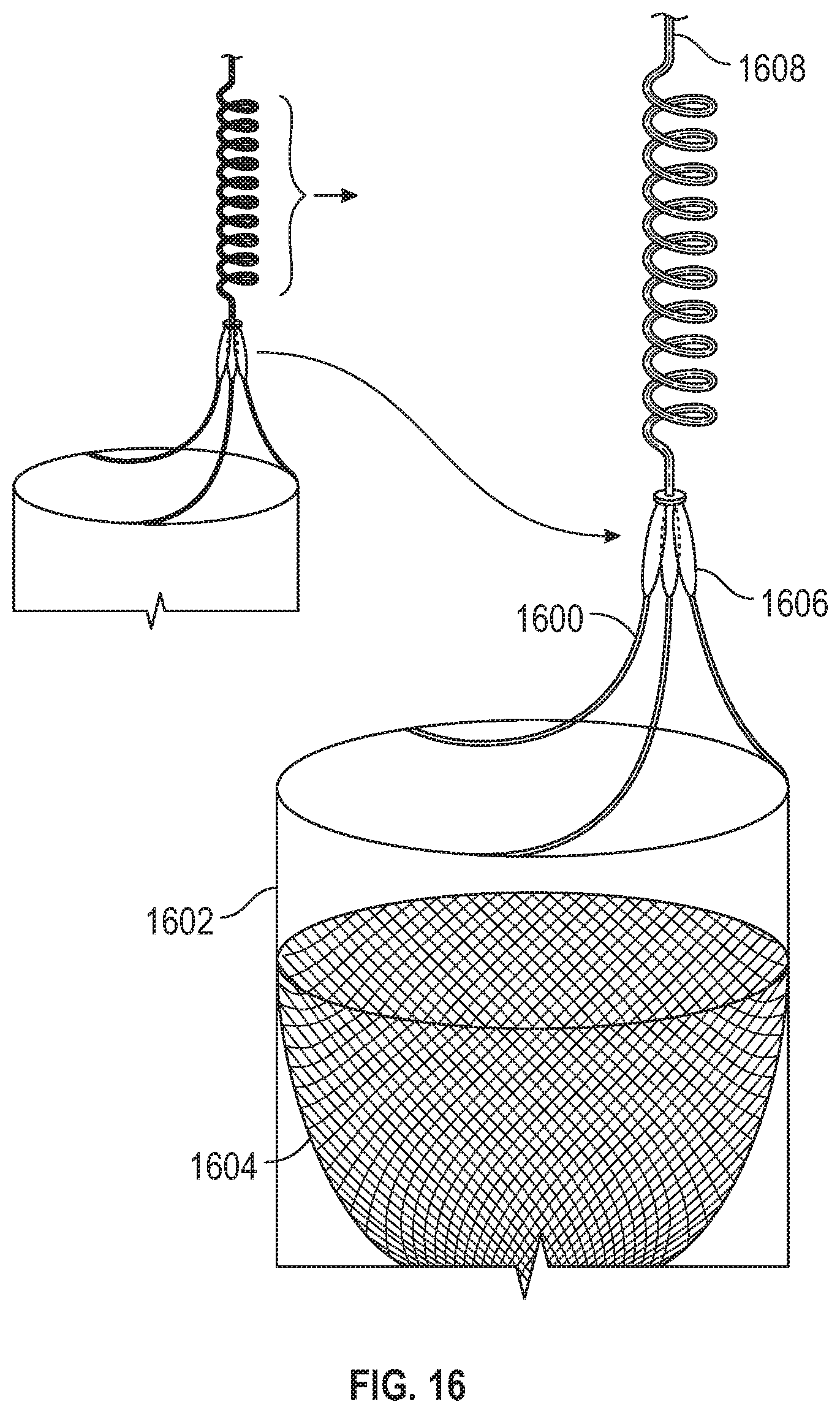 Patent US11779451 Figure 14 – Peripheral vascular filtration systems and methods