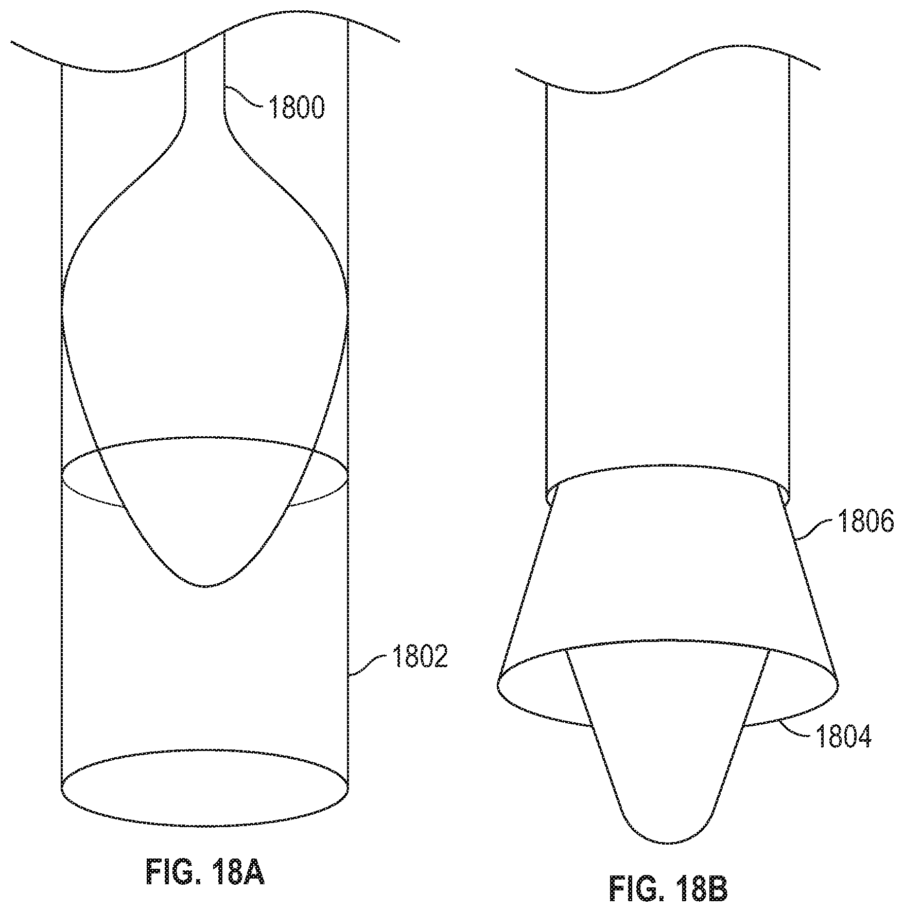Patent US11779451 Figure 16 – Peripheral vascular filtration systems and methods