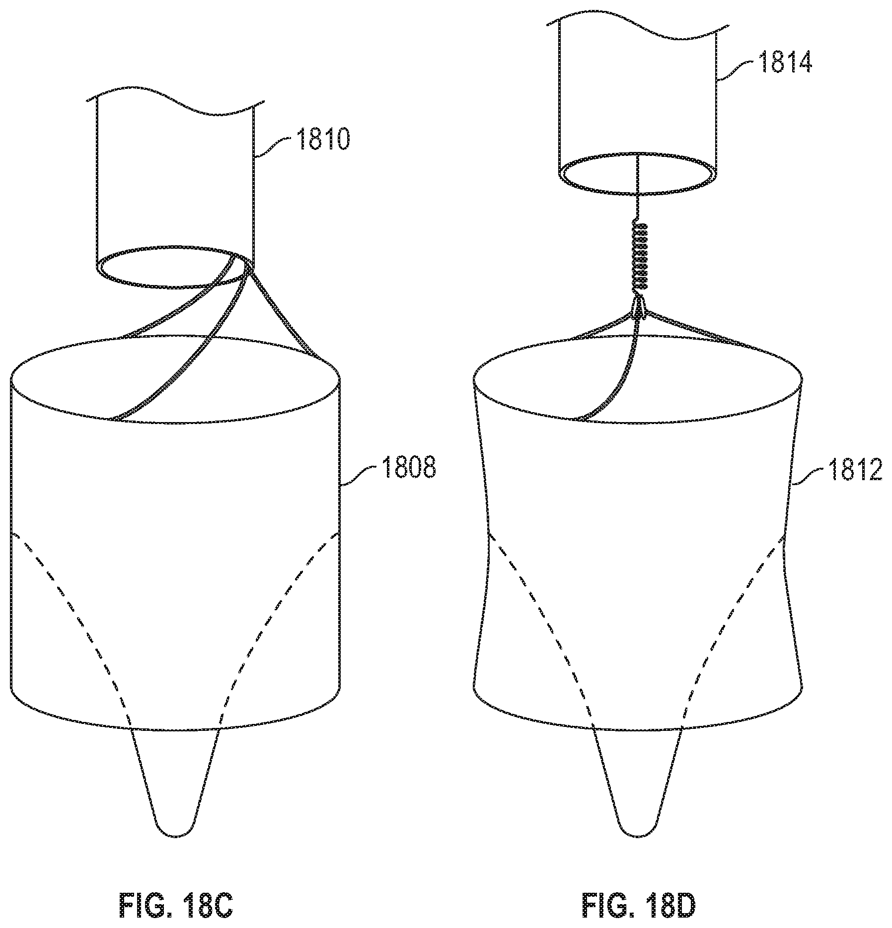 Patent US11779451 Figure 17 – Peripheral vascular filtration systems and methods