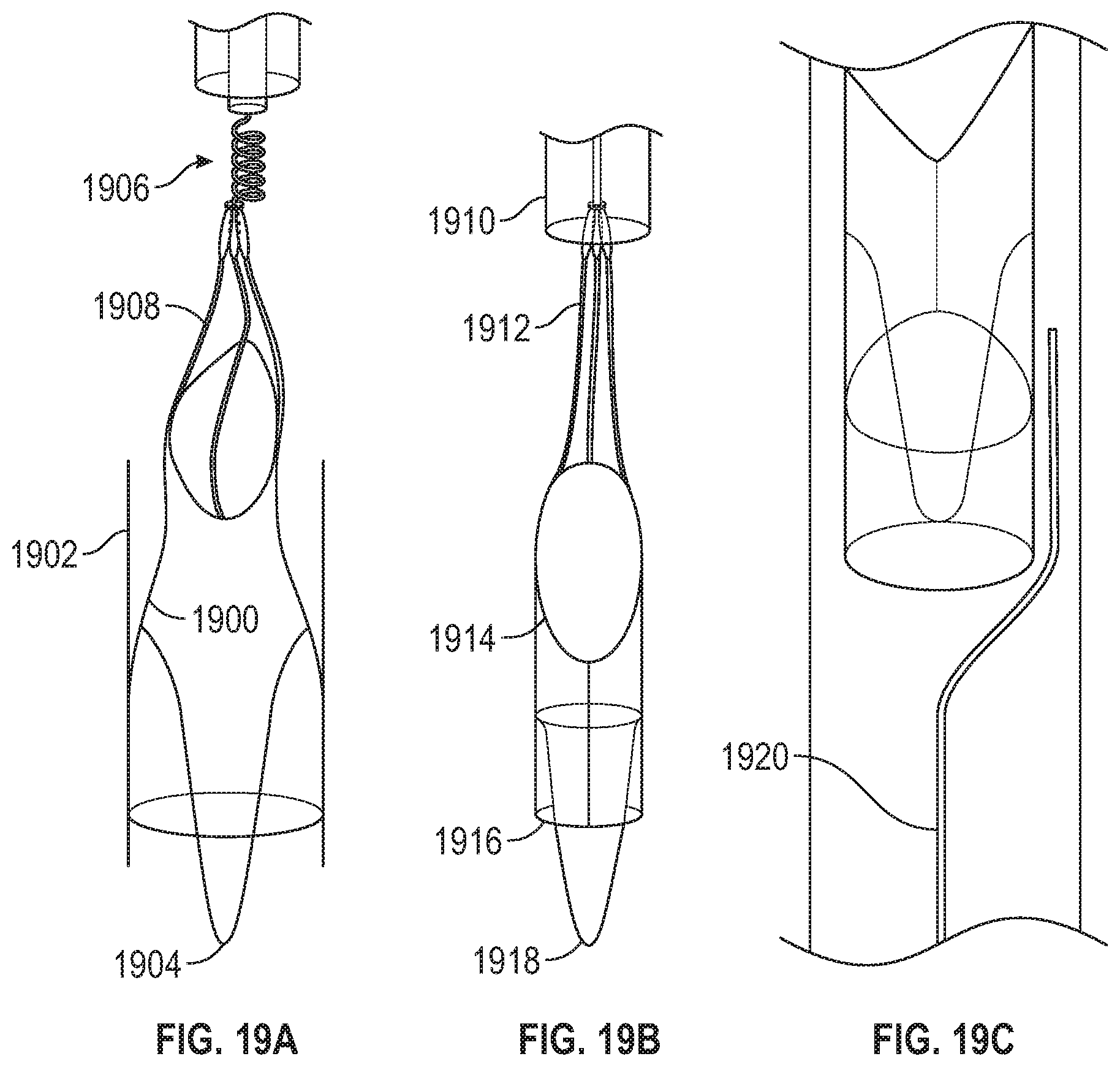 Patent US11779451 Figure 18 – Peripheral vascular filtration systems and methods