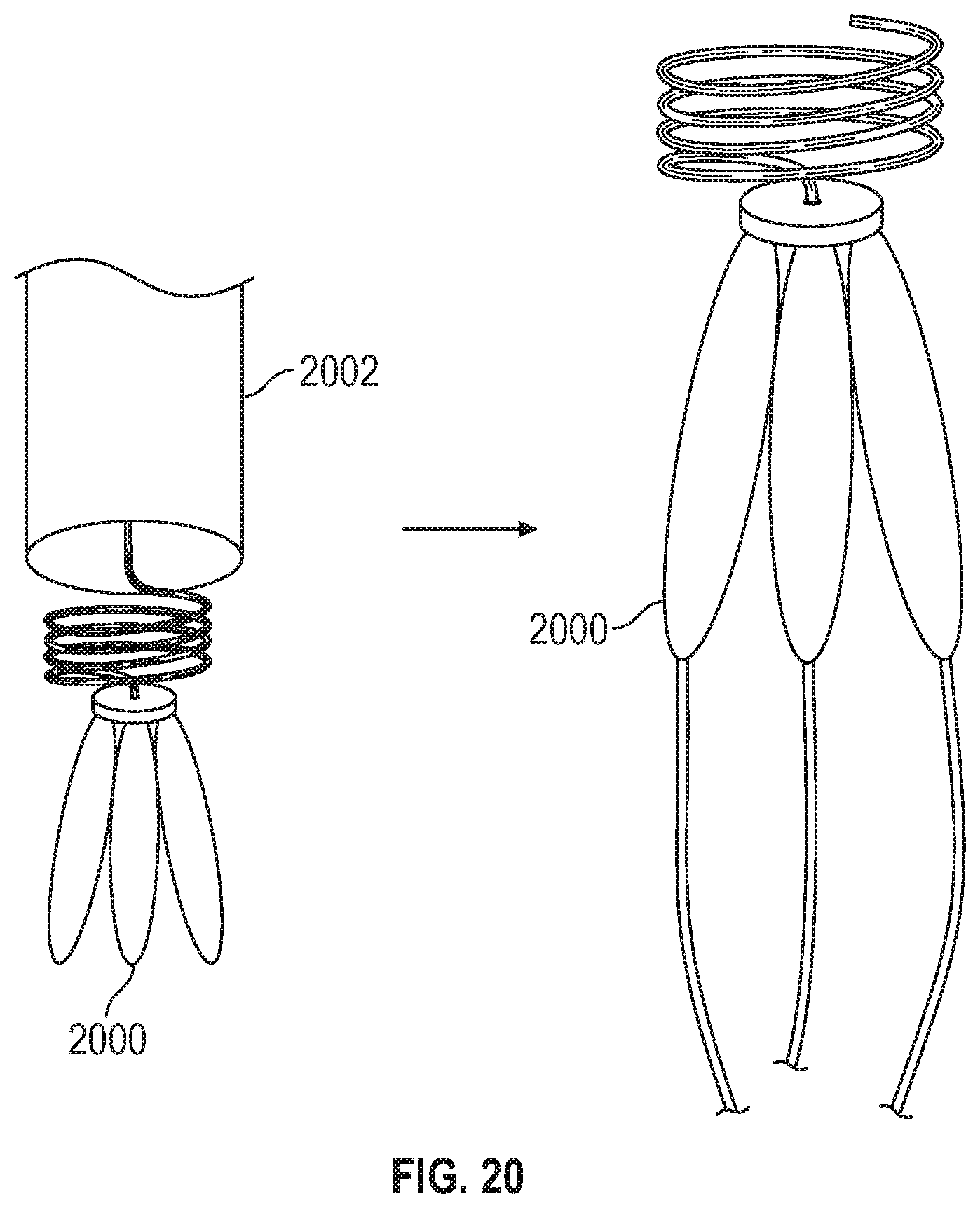 Patent US11779451 Figure 19 – Peripheral vascular filtration systems and methods