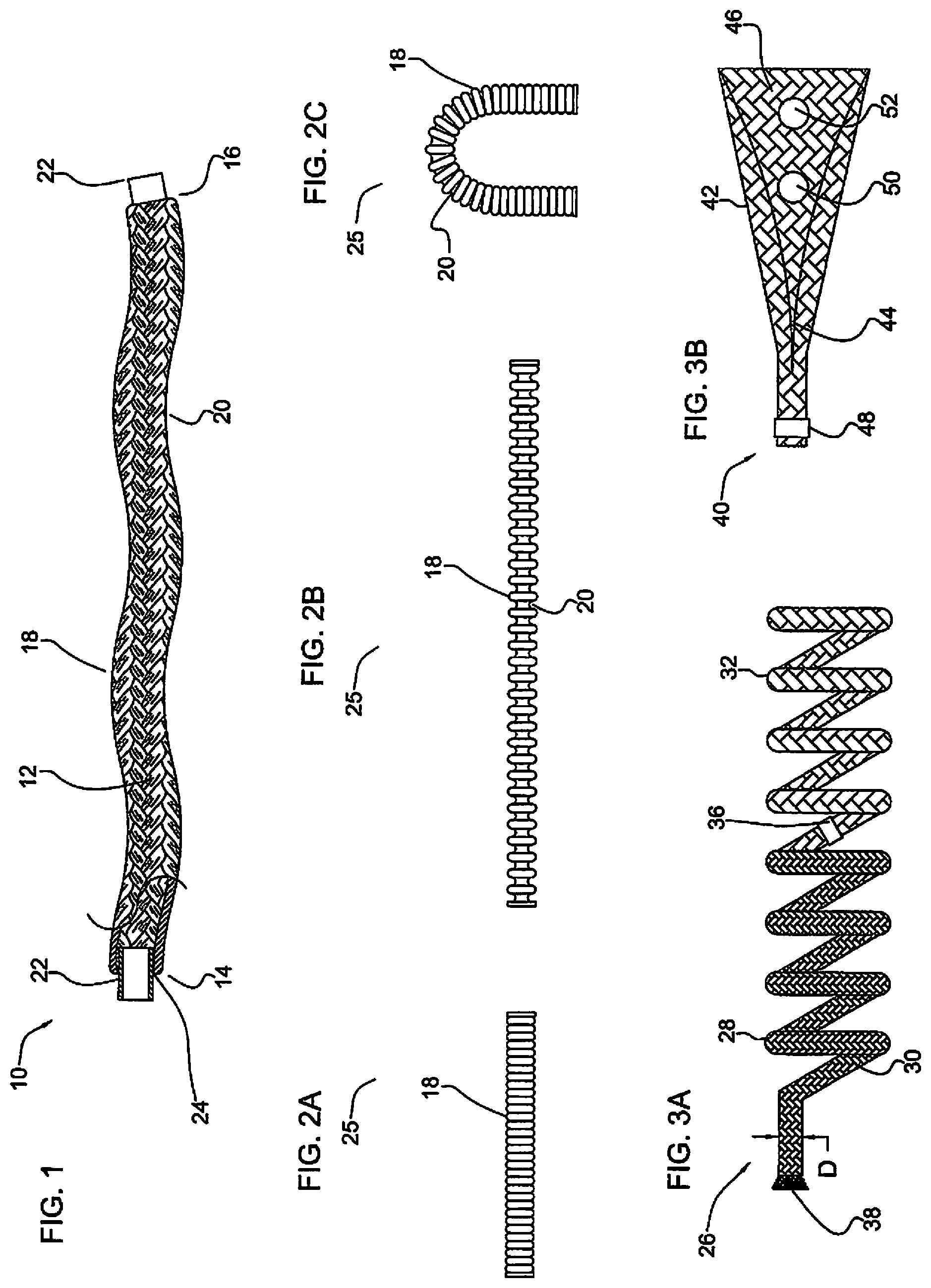 Patent US11779452 Figure 1 – Vascular implant