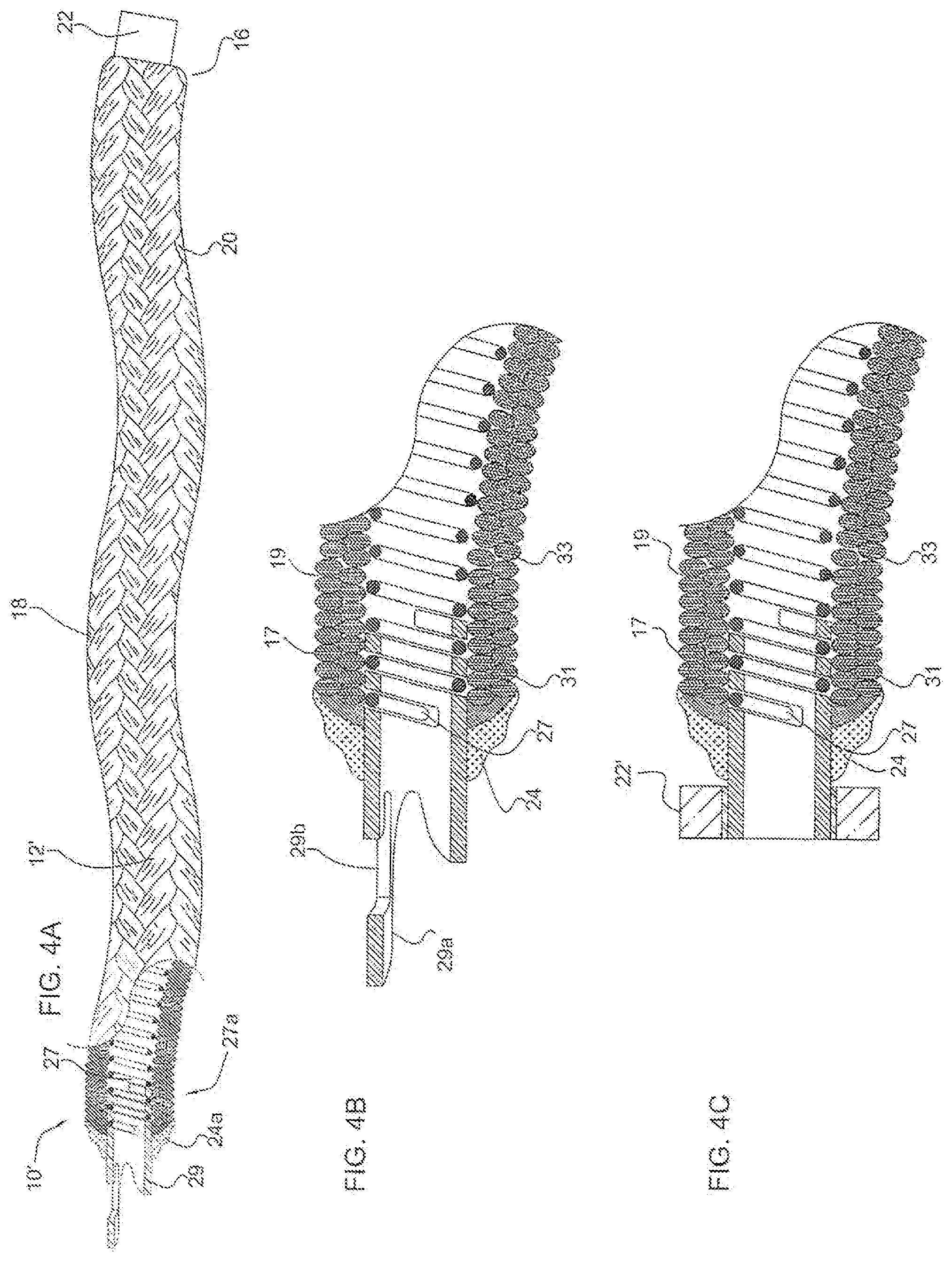 Patent US11779452 Figure 2 – Vascular implant