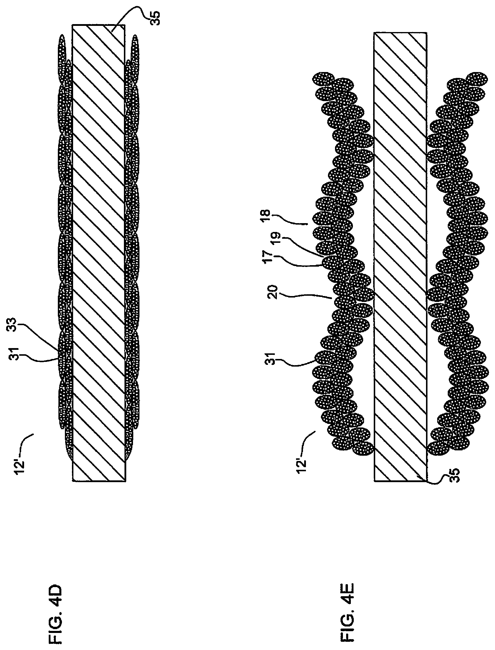 Patent US11779452 Figure 3 – Vascular implant
