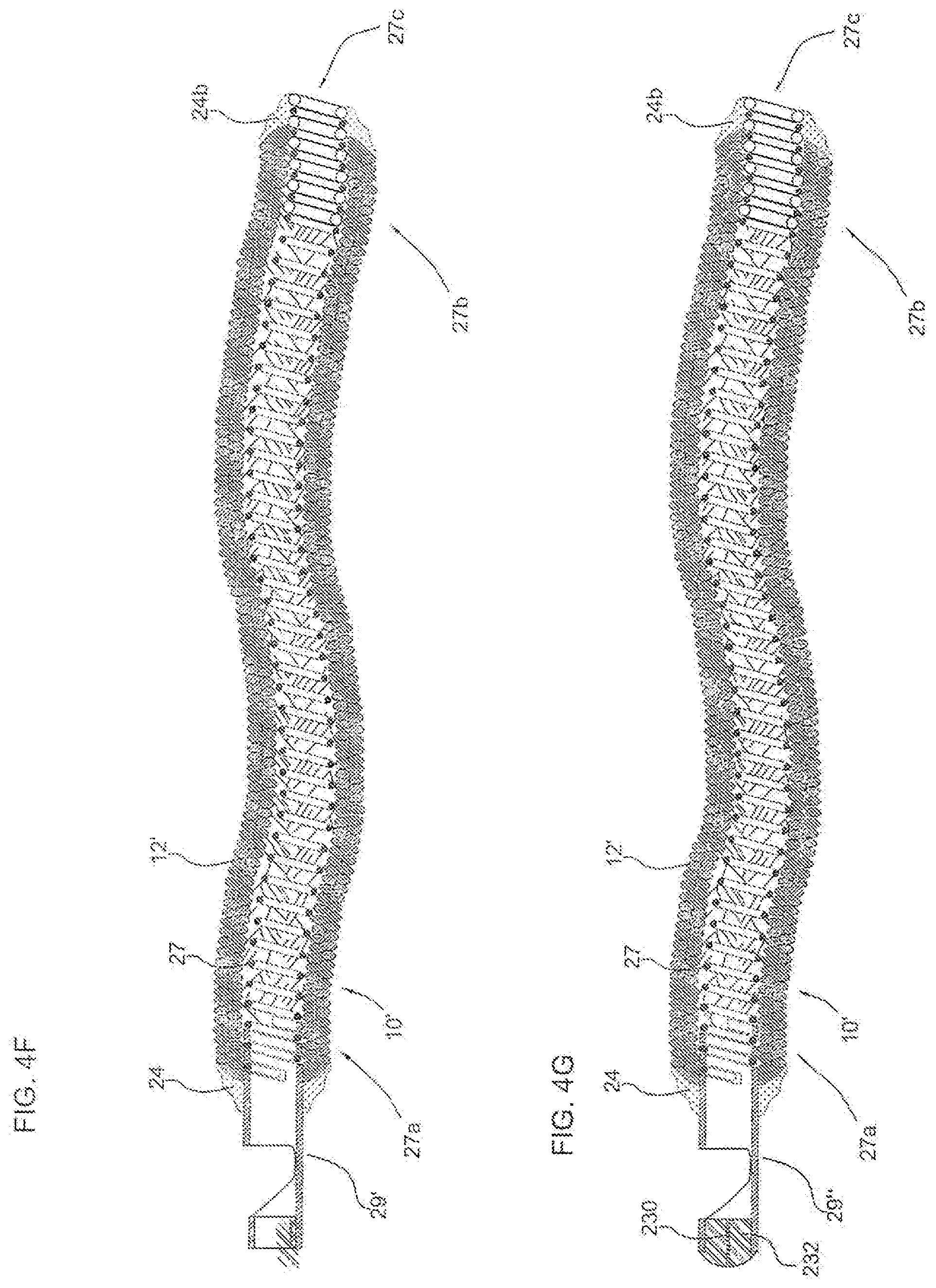 Patent US11779452 Figure 4 – Vascular implant