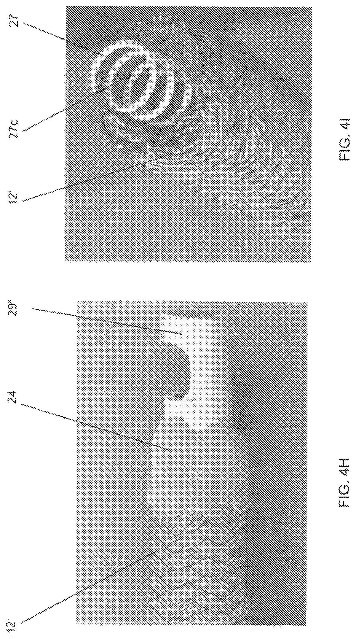 Patent US11779452 Figure 5 – Vascular implant