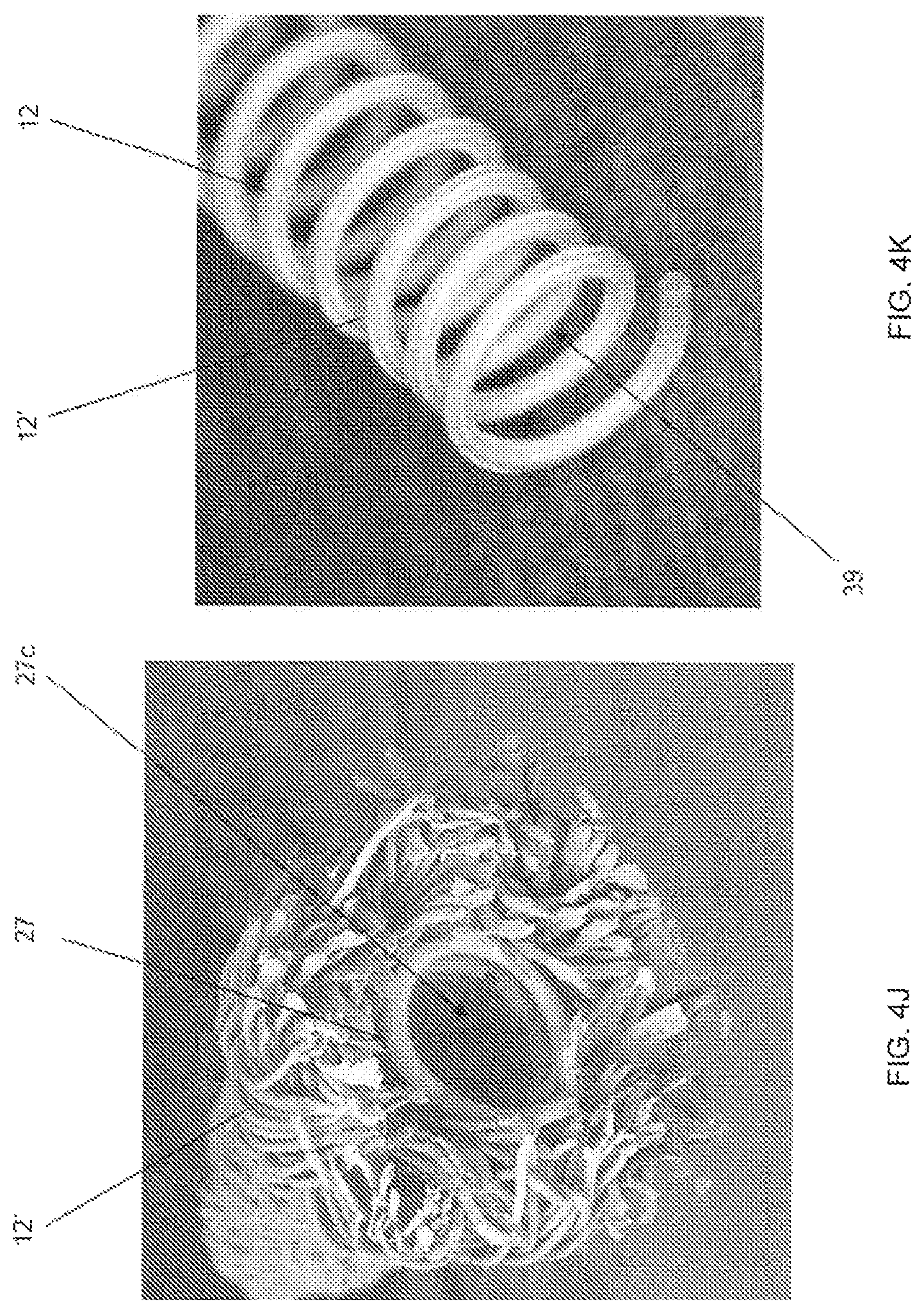 Patent US11779452 Figure 6 – Vascular implant