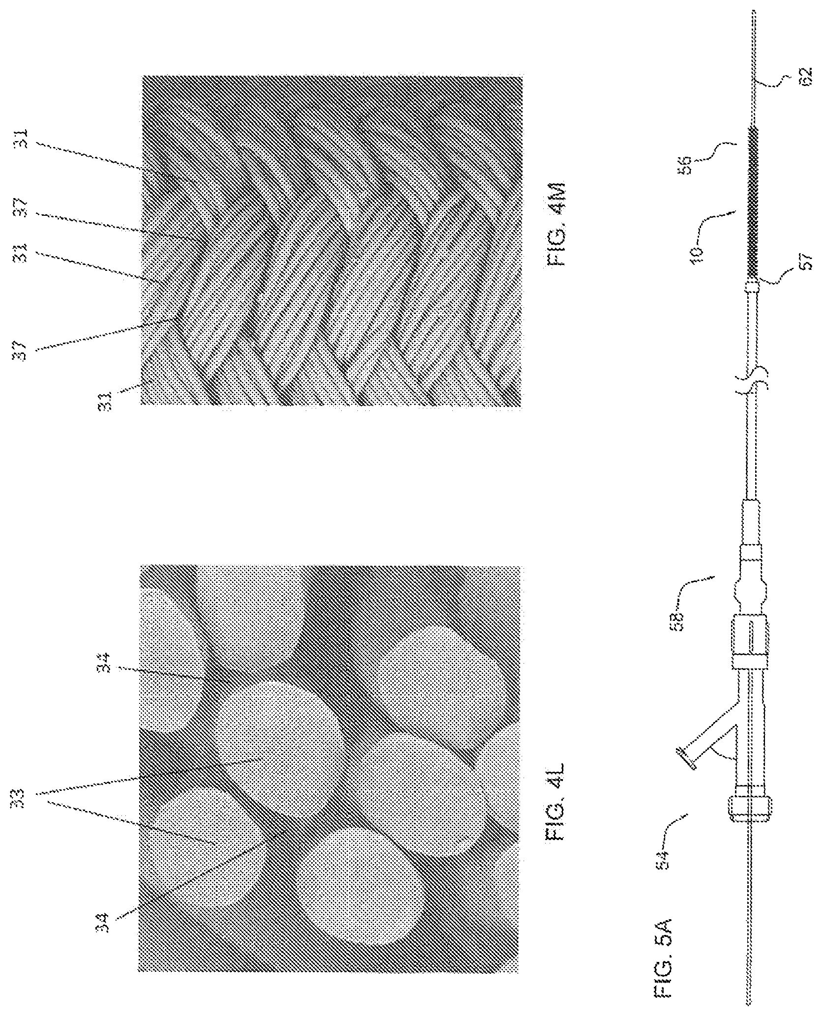Patent US11779452 Figure 7 – Vascular implant