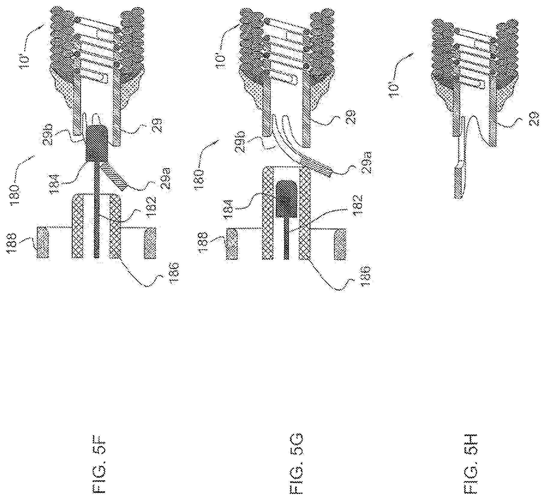 Patent US11779452 Figure 9 – Vascular implant