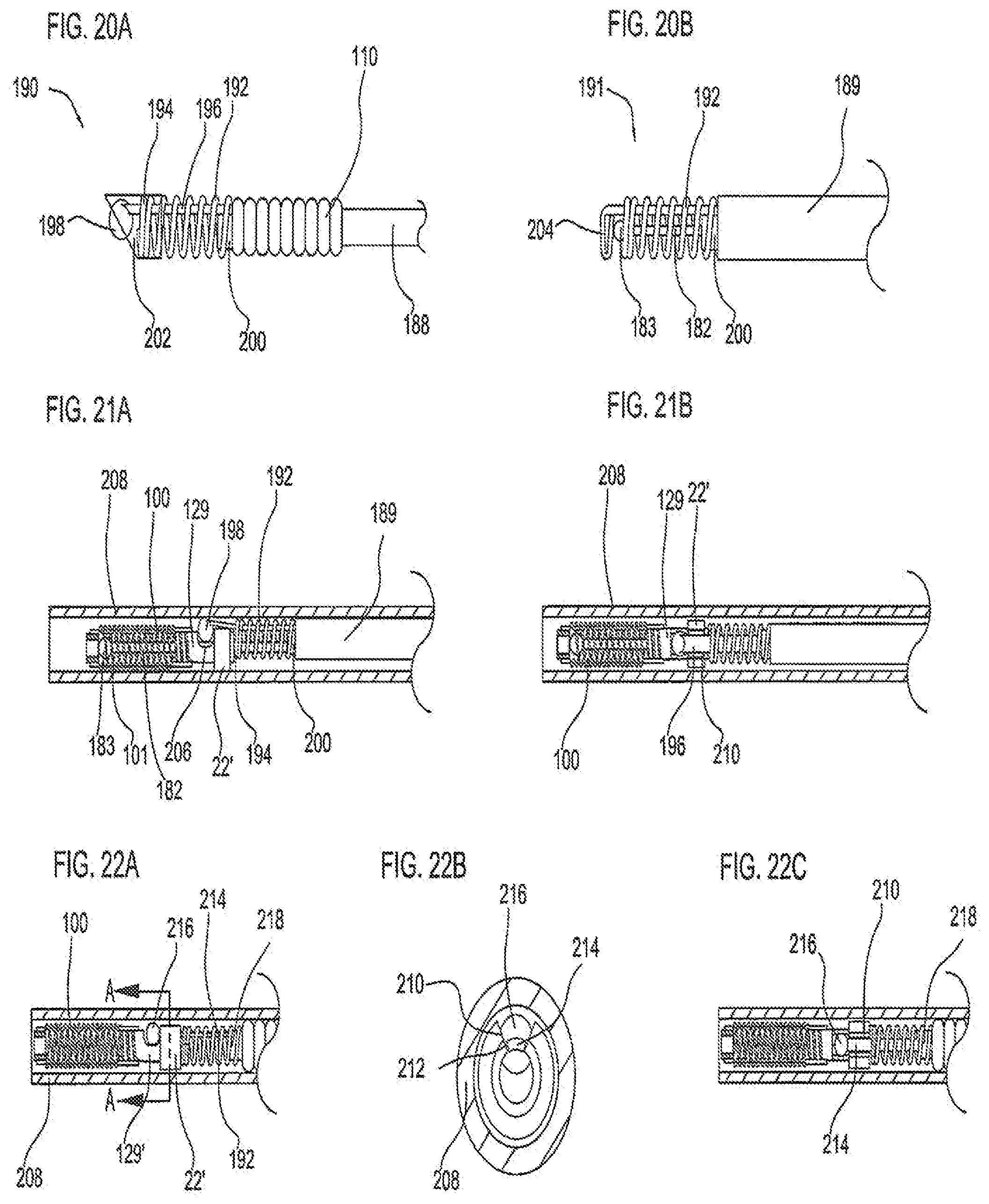 Patent US11779452 Figure 18 – Vascular implant