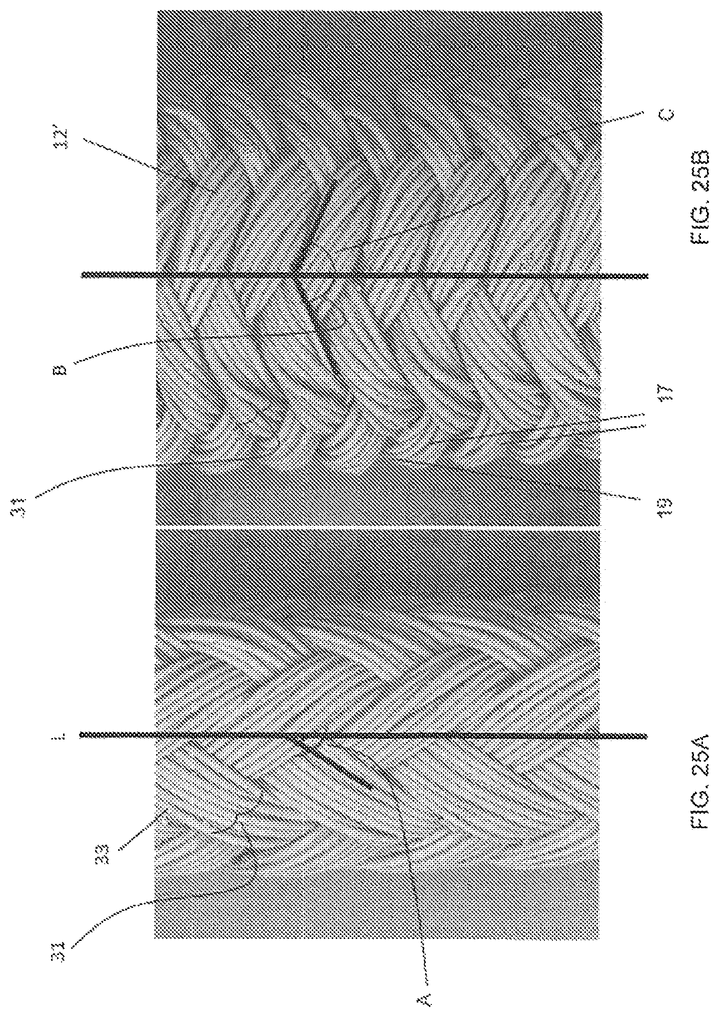 Patent US11779452 Figure 20 – Vascular implant