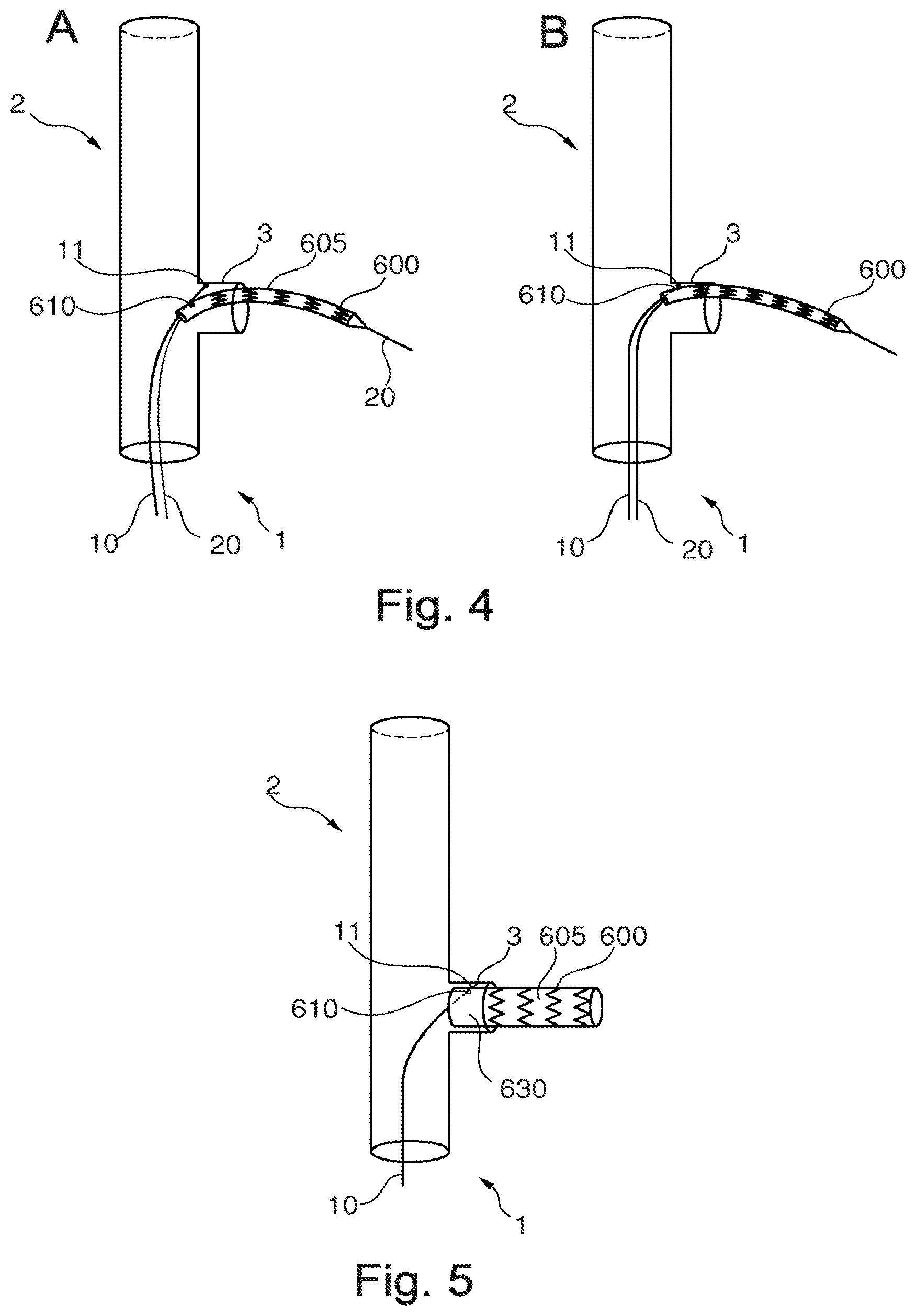 Patent US11779453 Figure 3 – Stent-graft prosthesis, system and method for improved delivery of a stent-graft prosthesis