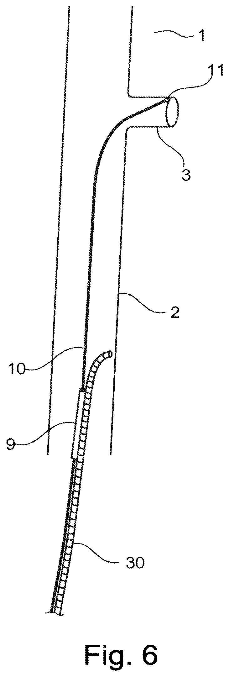 Patent US11779453 Figure 4 – Stent-graft prosthesis, system and method for improved delivery of a stent-graft prosthesis