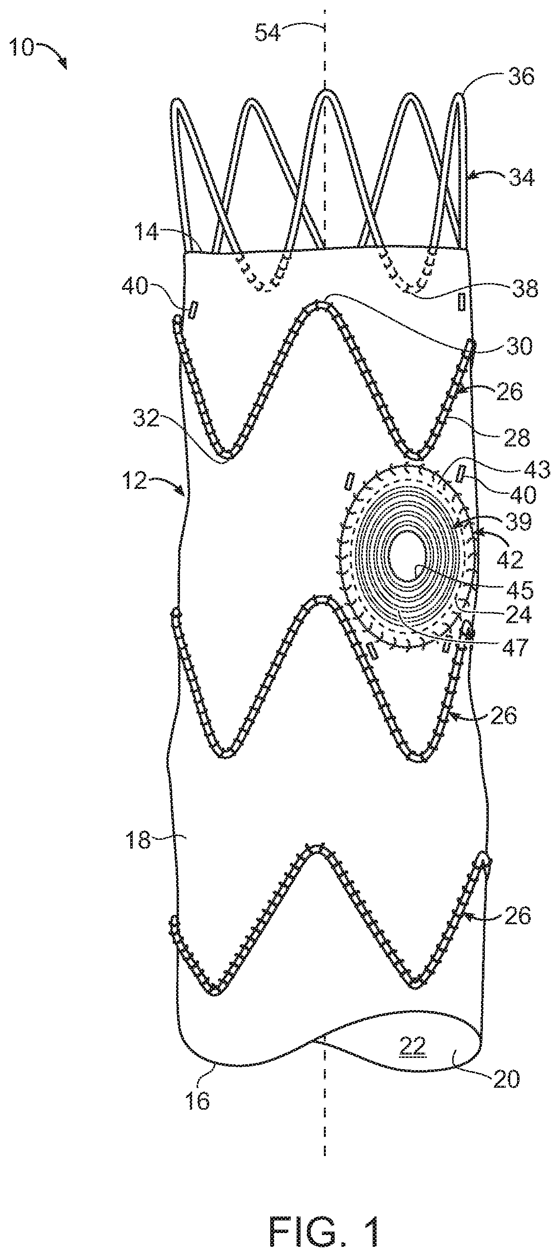 Patent US11779454 Figure 1 – Vascular prosthesis with crimped adapter and methods of use