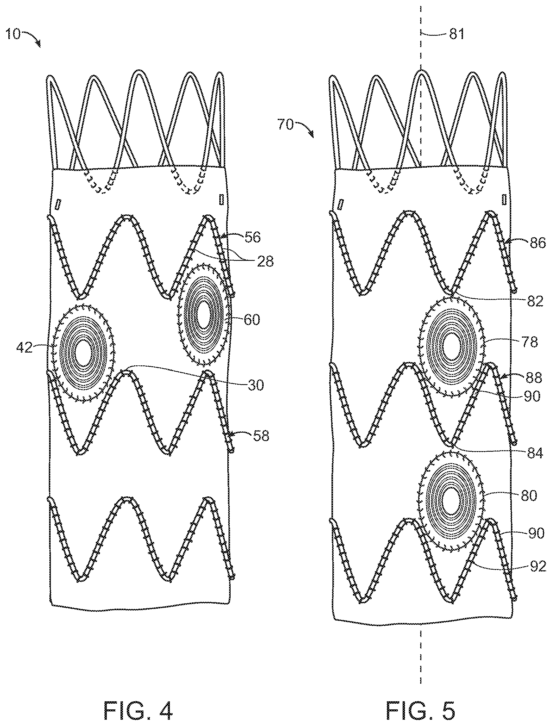 Patent US11779454 Figure 3 – Vascular prosthesis with crimped adapter and methods of use