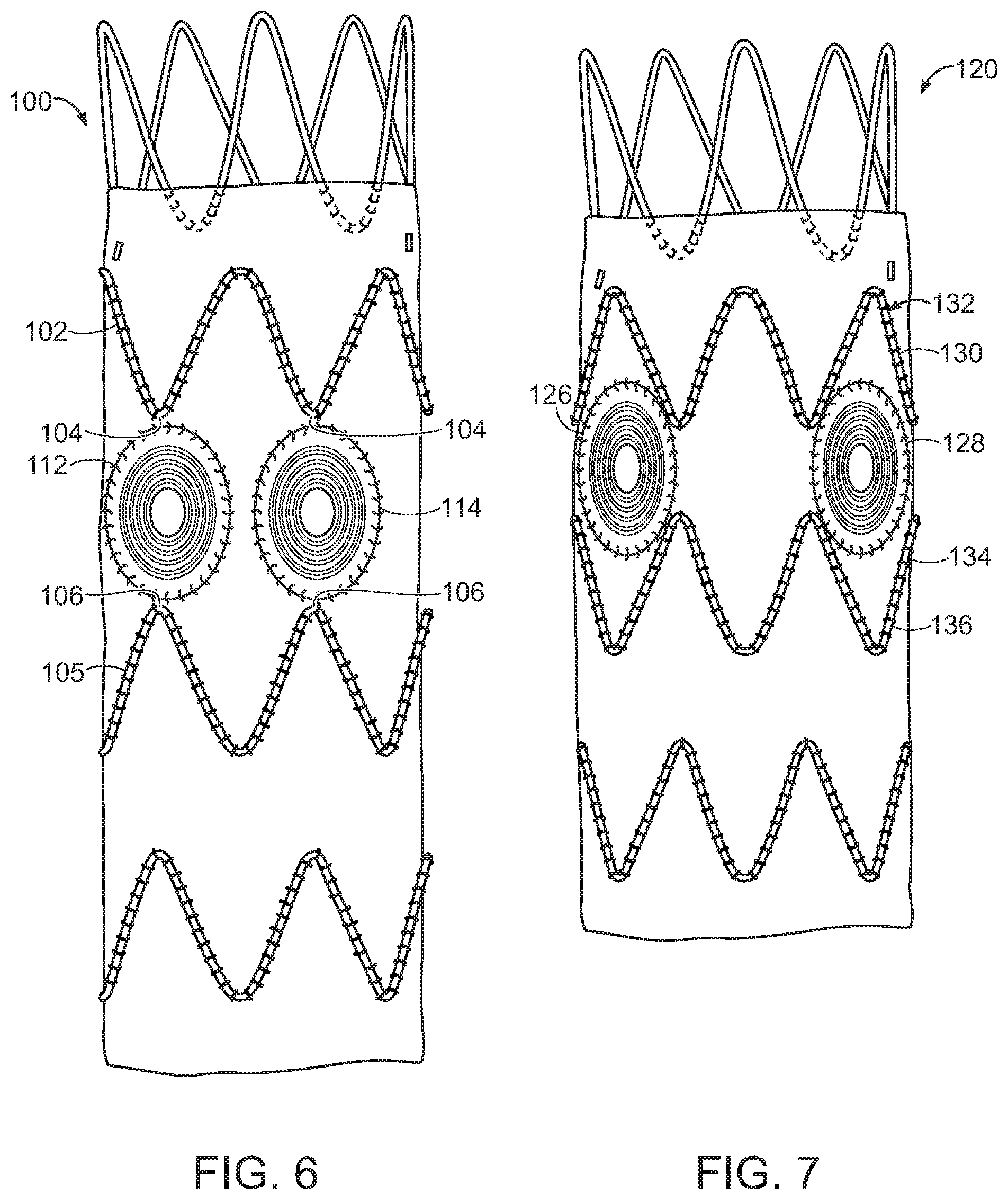 Patent US11779454 Figure 4 – Vascular prosthesis with crimped adapter and methods of use