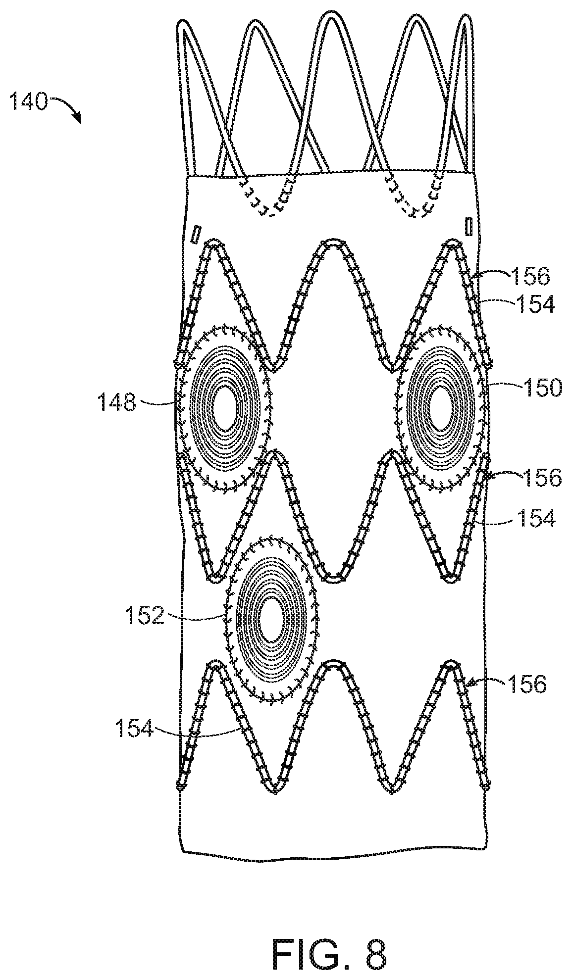 Patent US11779454 Figure 5 – Vascular prosthesis with crimped adapter and methods of use