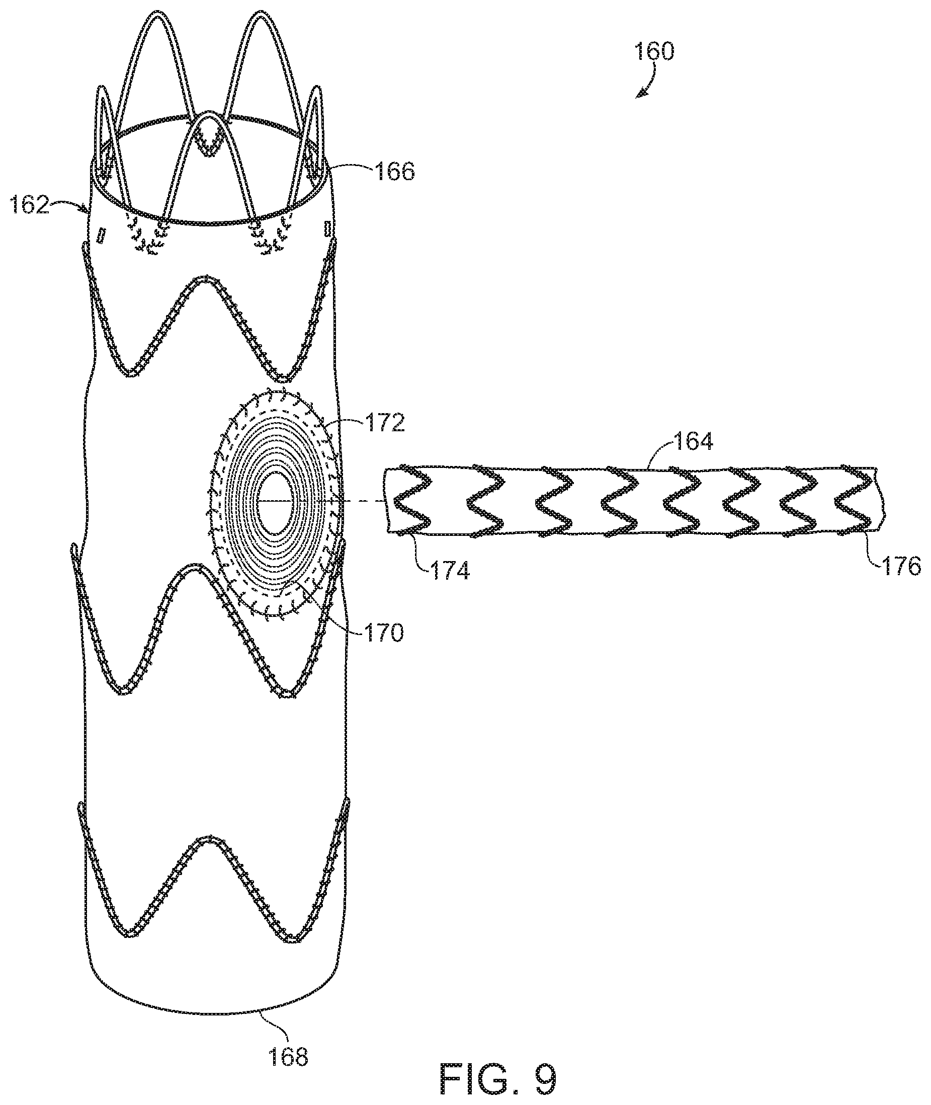 Patent US11779454 Figure 6 – Vascular prosthesis with crimped adapter and methods of use