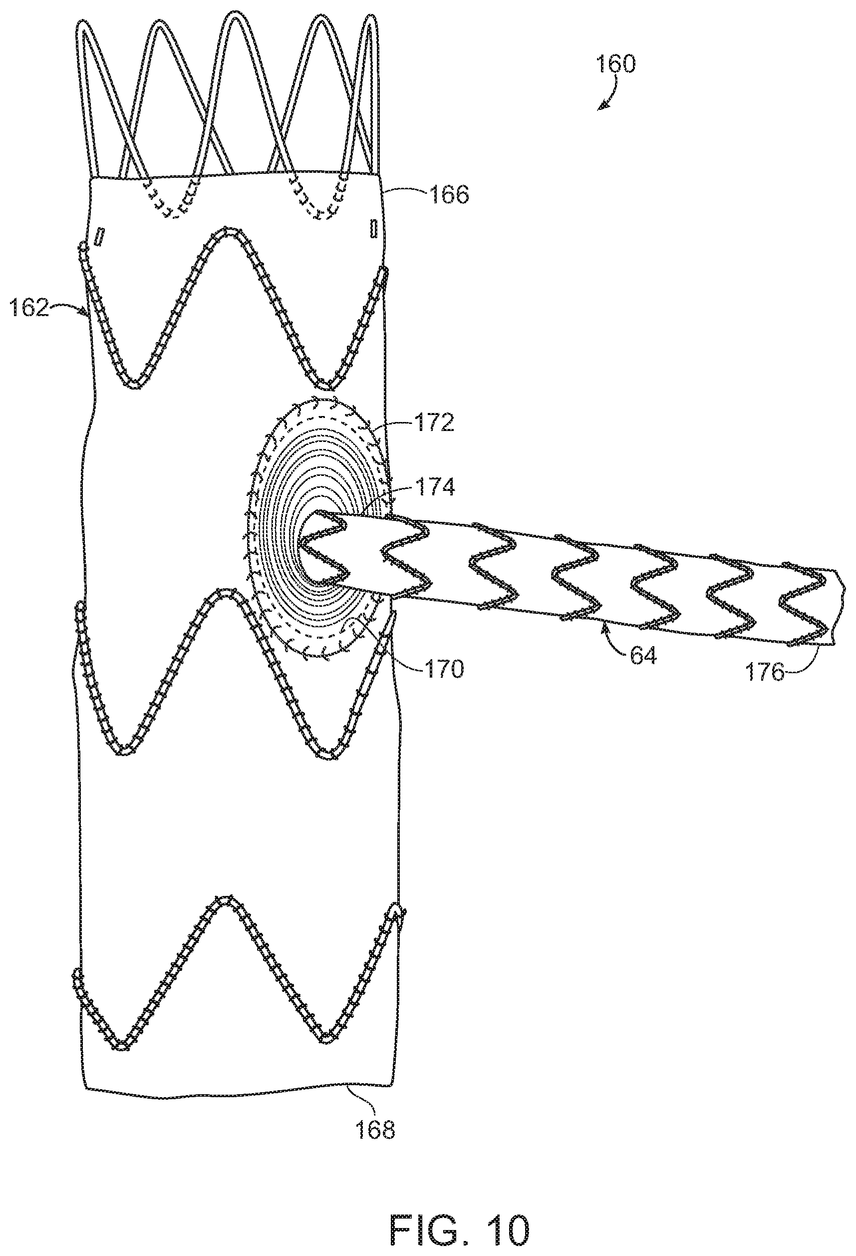 Patent US11779454 Figure 7 – Vascular prosthesis with crimped adapter and methods of use