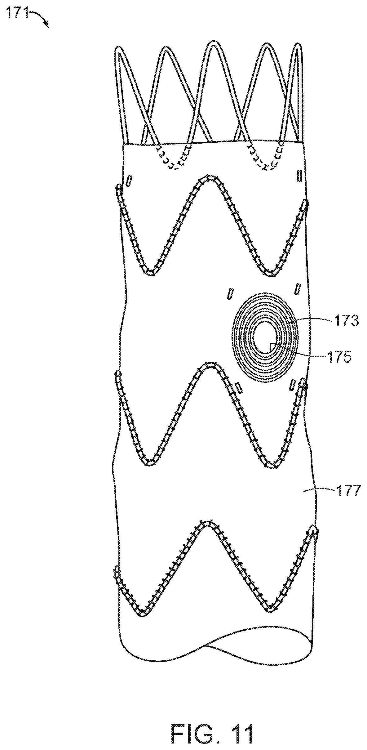 Patent US11779454 Figure 8 – Vascular prosthesis with crimped adapter and methods of use