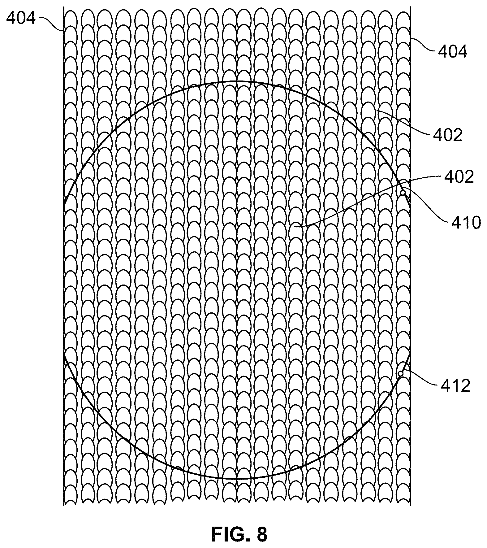 Patent US11779455 Figure 6 – Medical devices to limit movement of breast implants