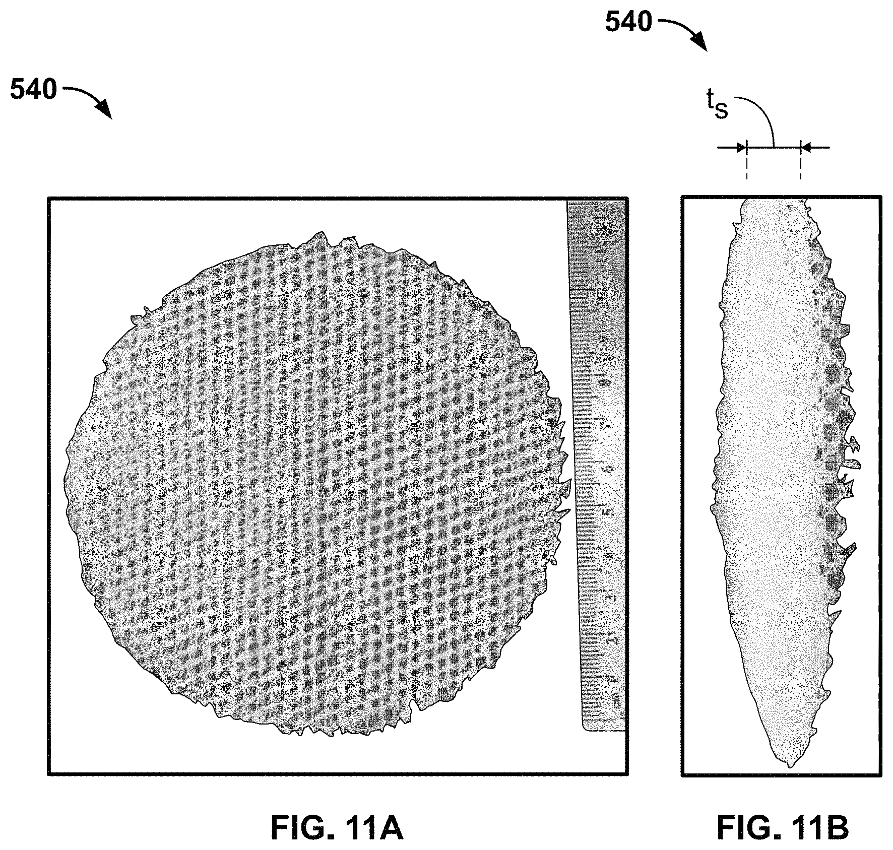 Patent US11779455 Figure 9 – Medical devices to limit movement of breast implants