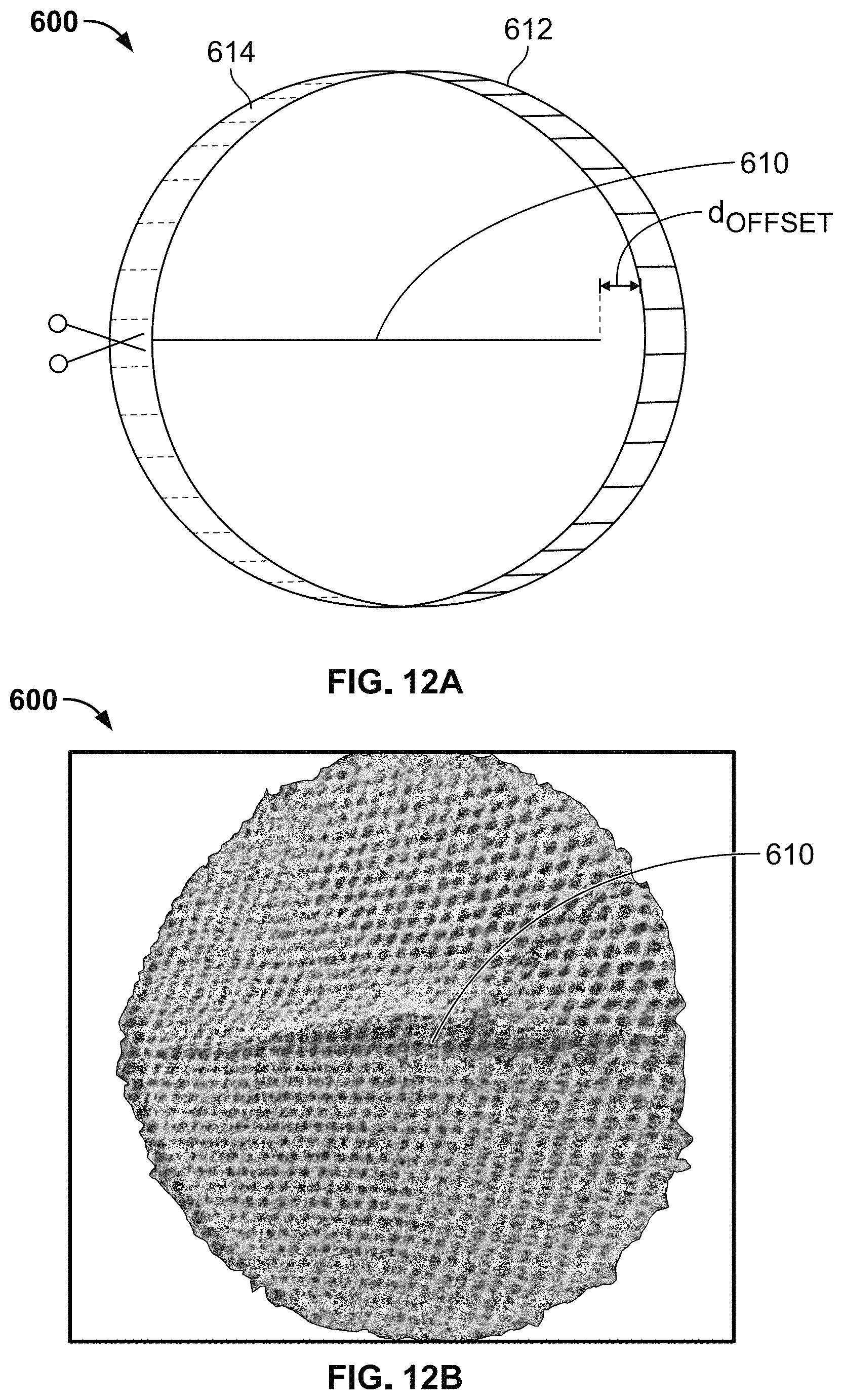 Patent US11779455 Figure 10 – Medical devices to limit movement of breast implants