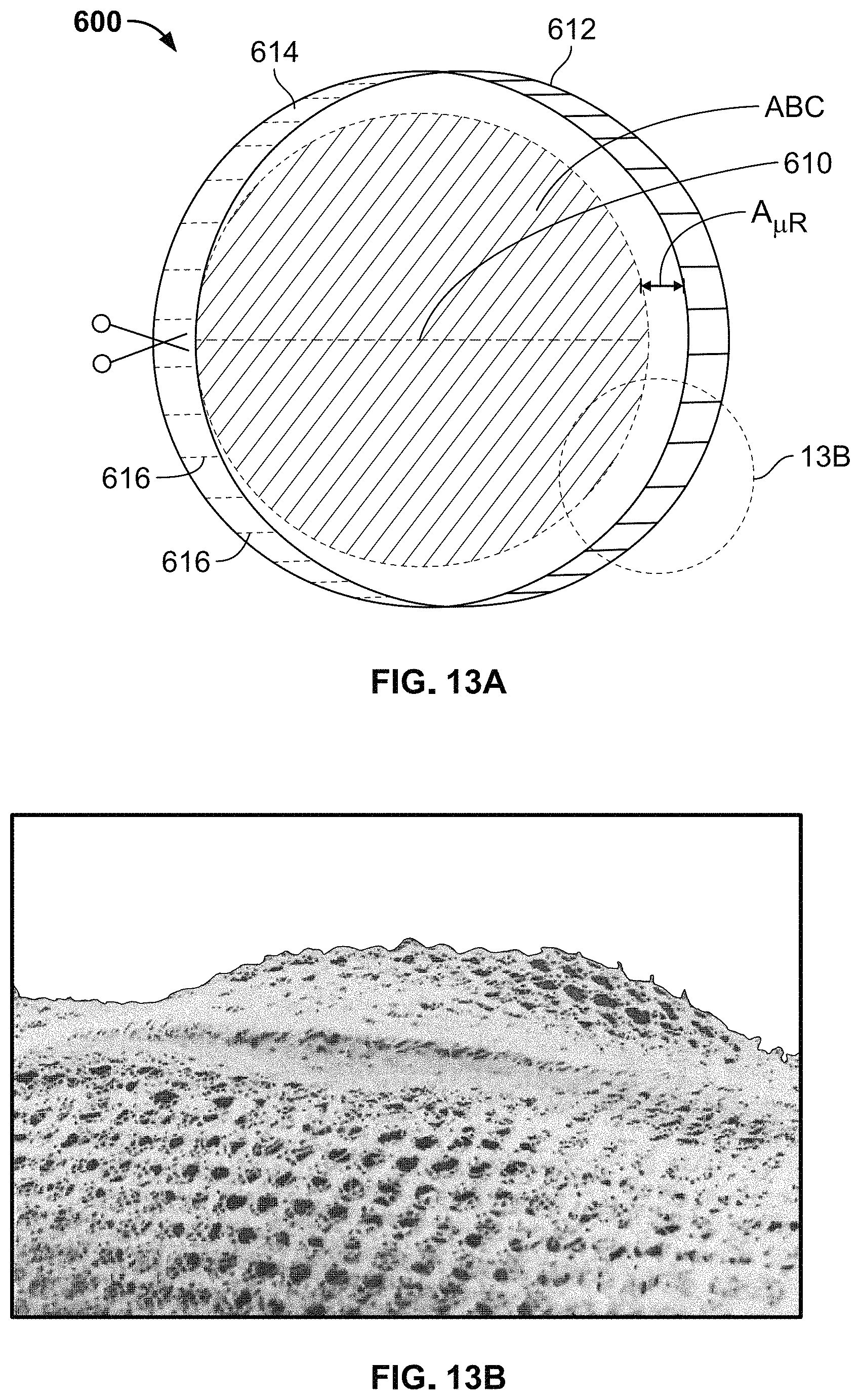 Patent US11779455 Figure 11 – Medical devices to limit movement of breast implants