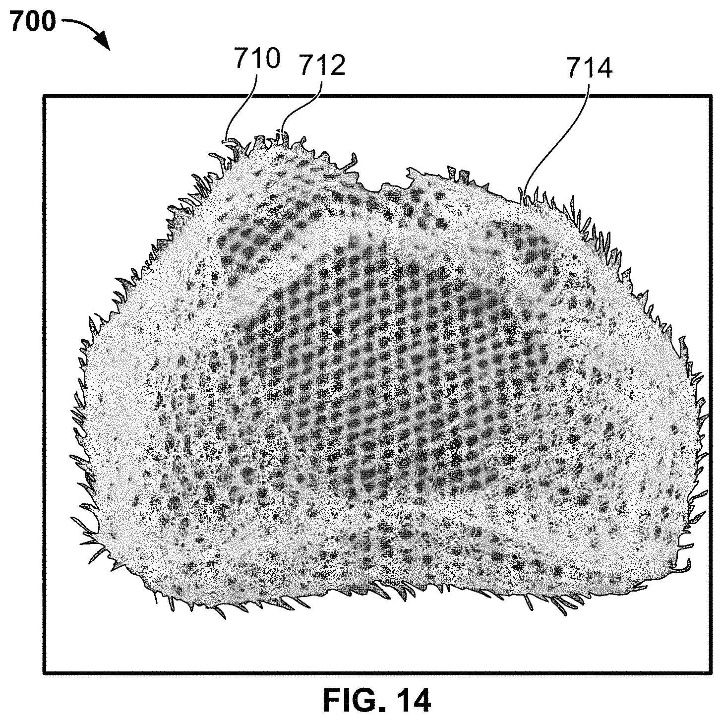 Patent US11779455 Figure 12 – Medical devices to limit movement of breast implants