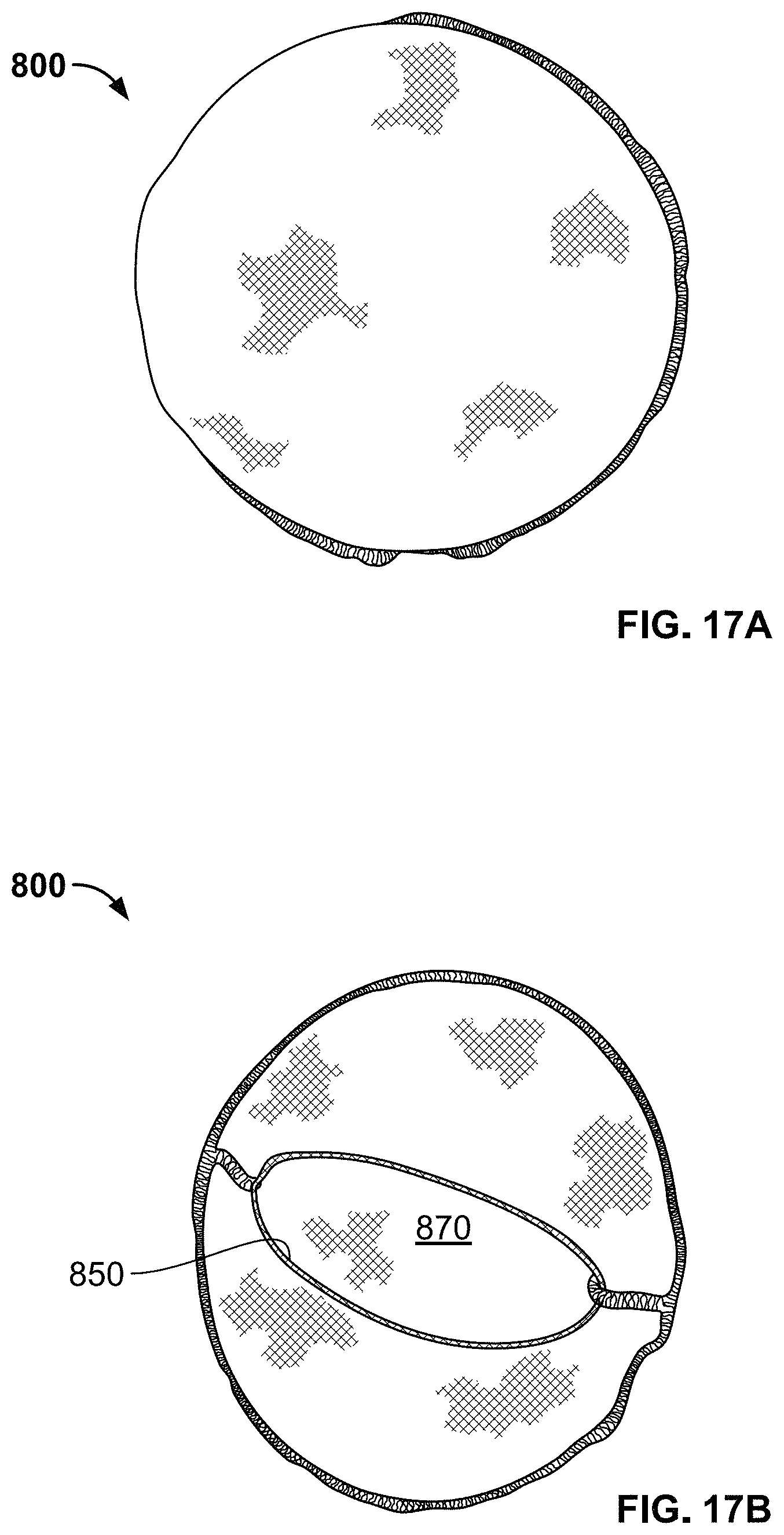 Patent US11779455 Figure 14 – Medical devices to limit movement of breast implants