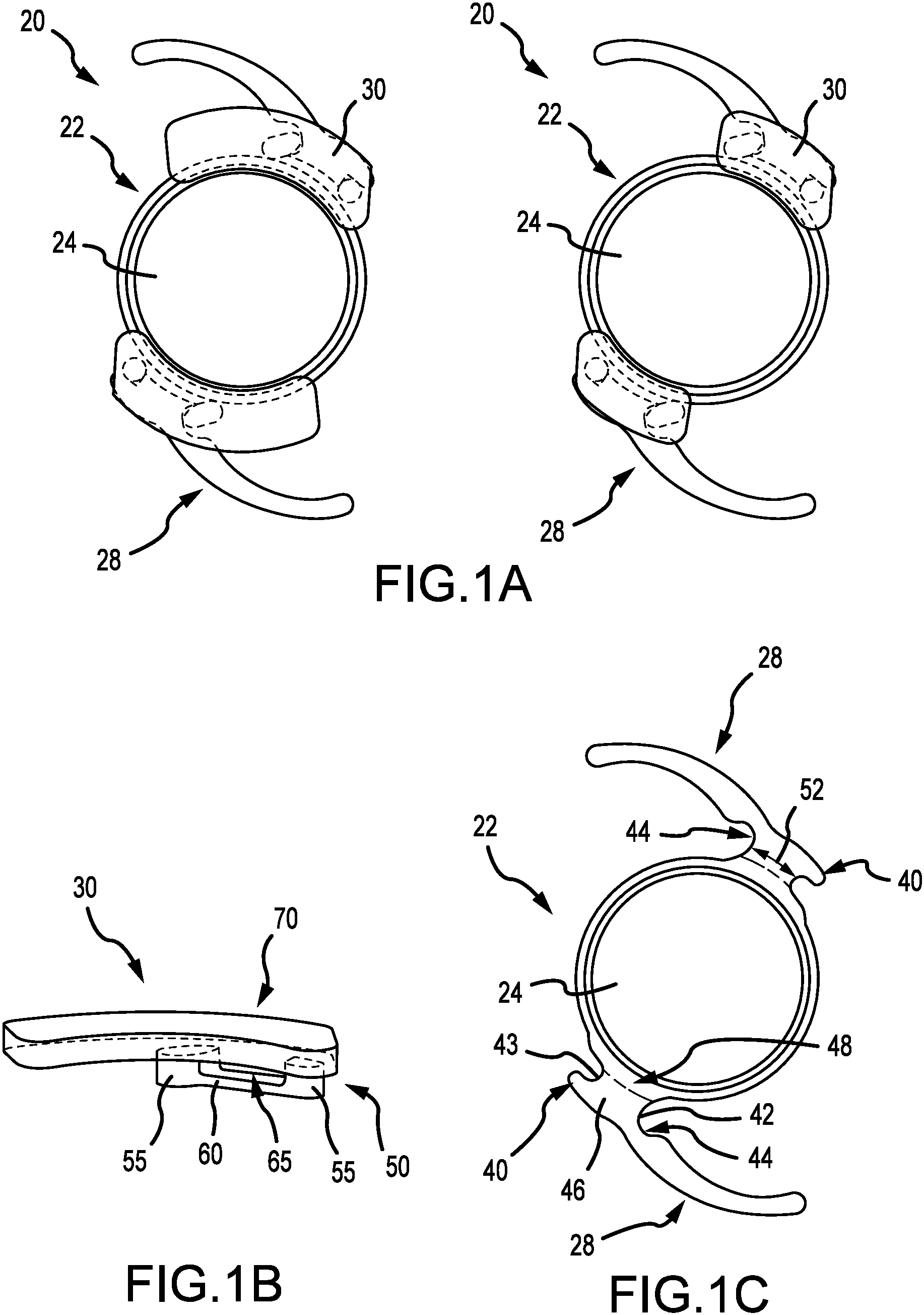 Patent US11779457 Figure 1 – Systems to affix devices to intraocular lens assemblies and related methods