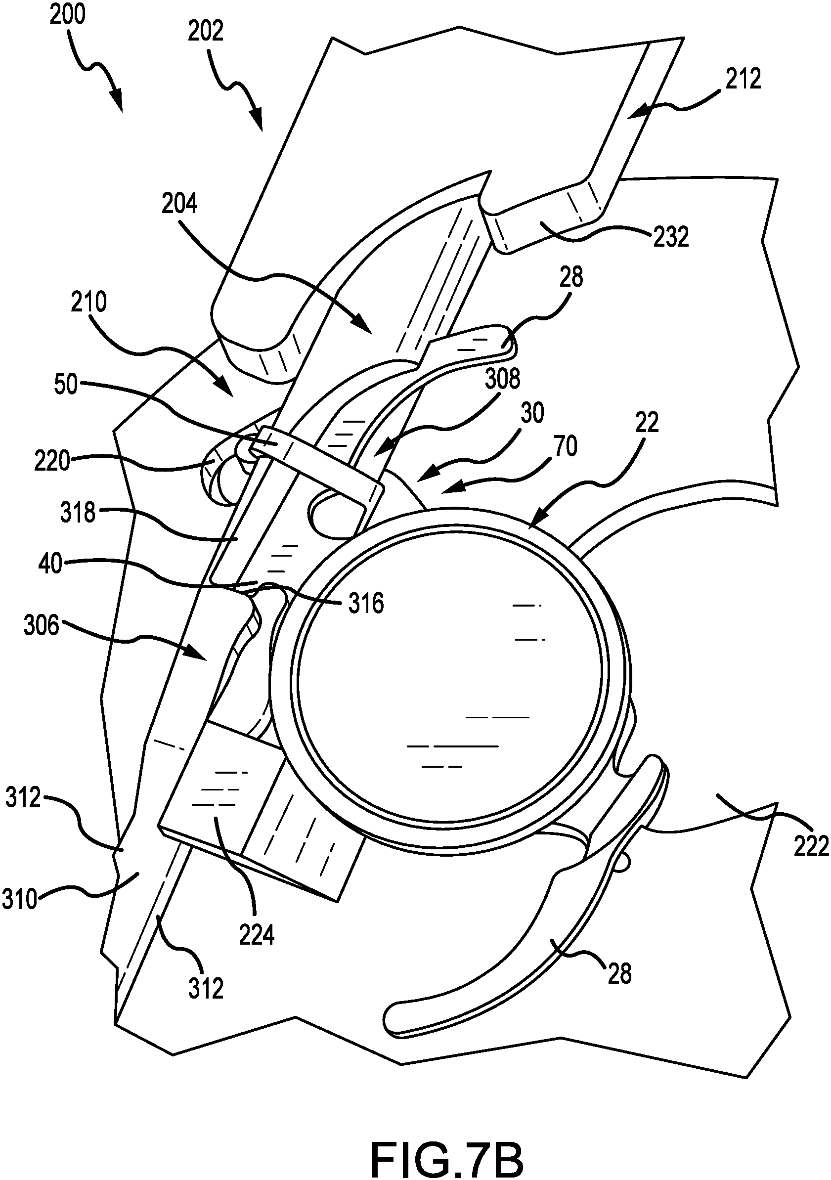 Patent US11779457 Figure 11 – Systems to affix devices to intraocular lens assemblies and related methods